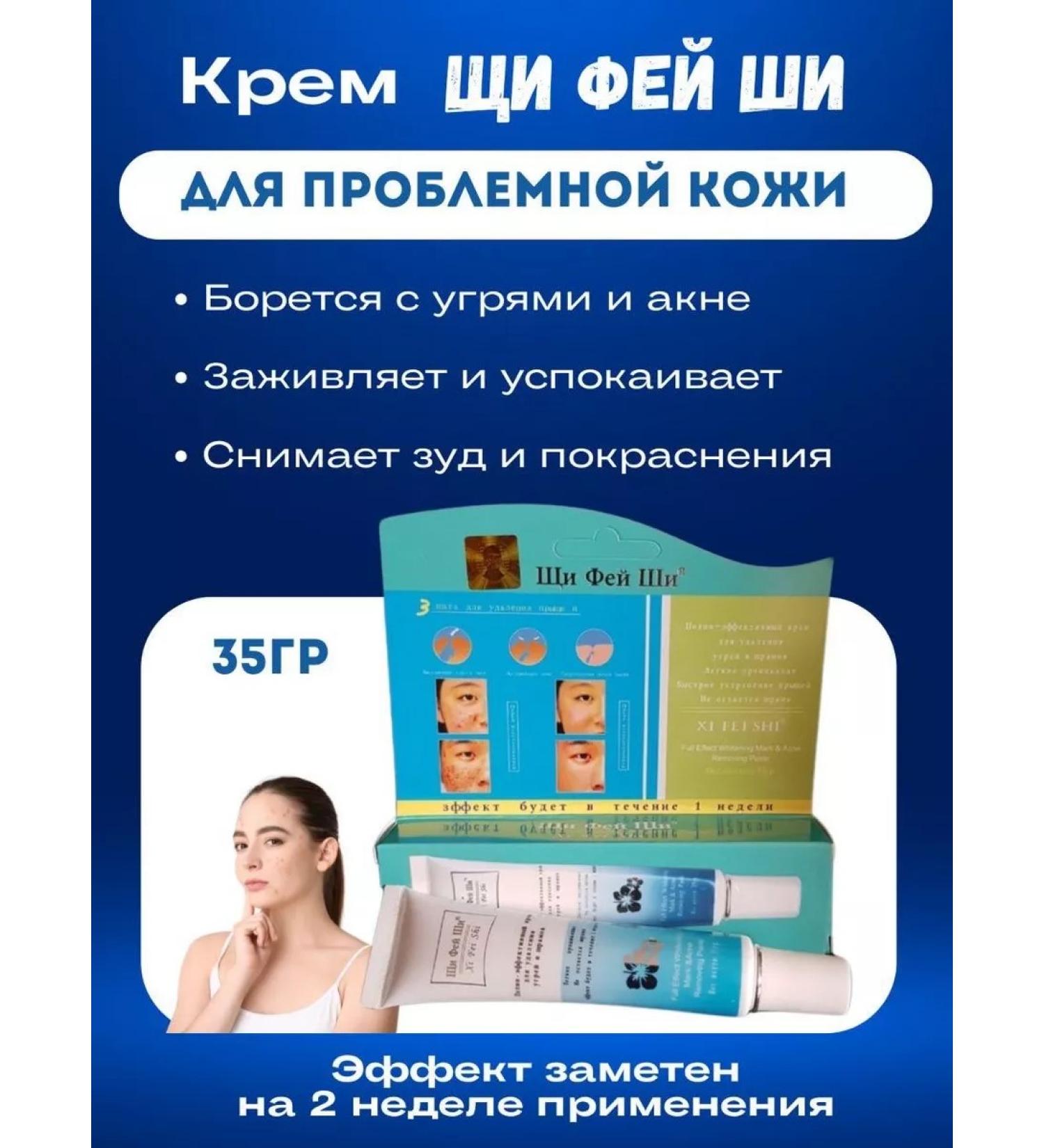 Xi Fei Shi Acne for removal of acne and scars 35 grams