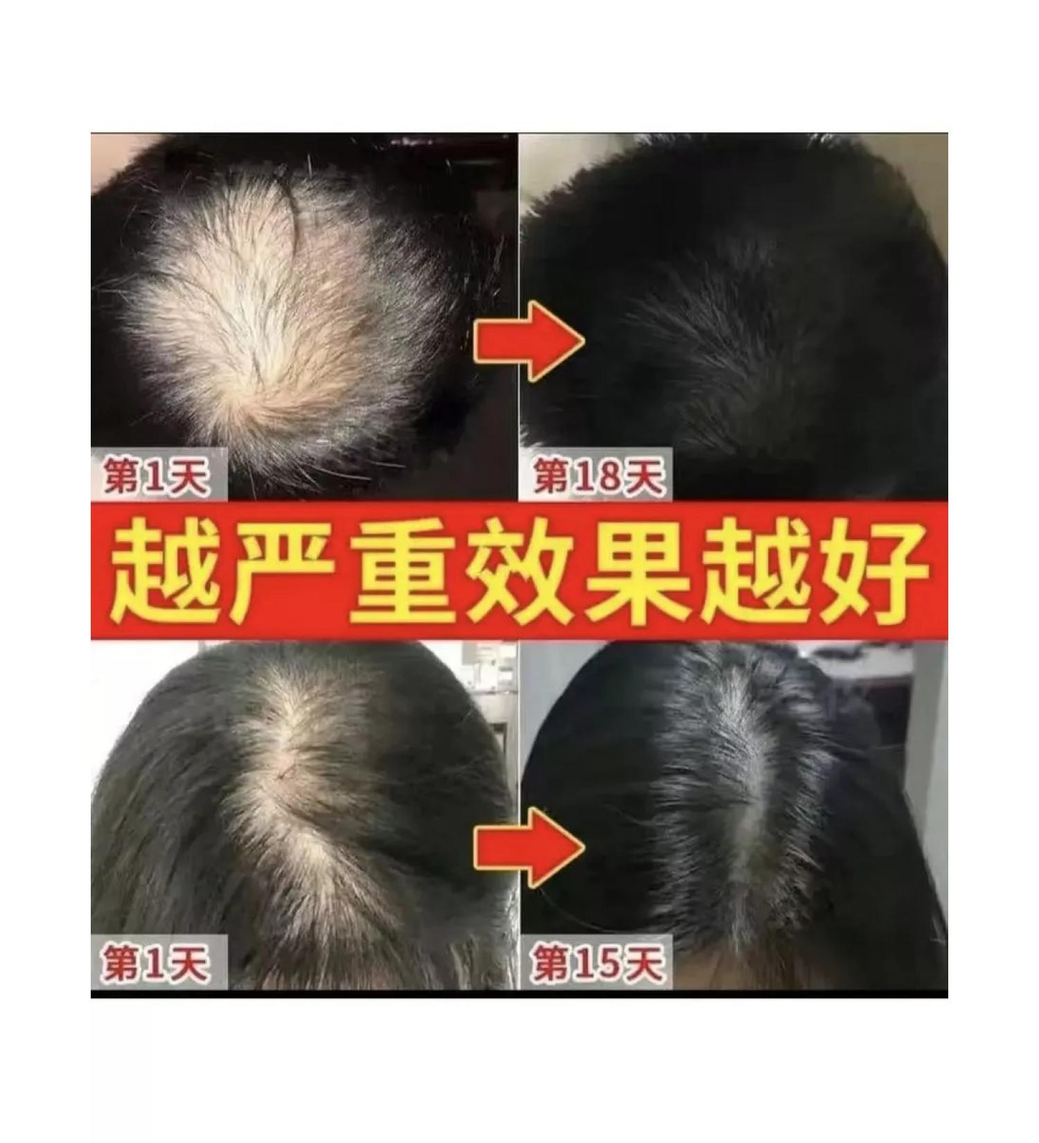 Deadline Soap from loss and hair growth 3 pcs. Original - Buy Online on GoSupps.com