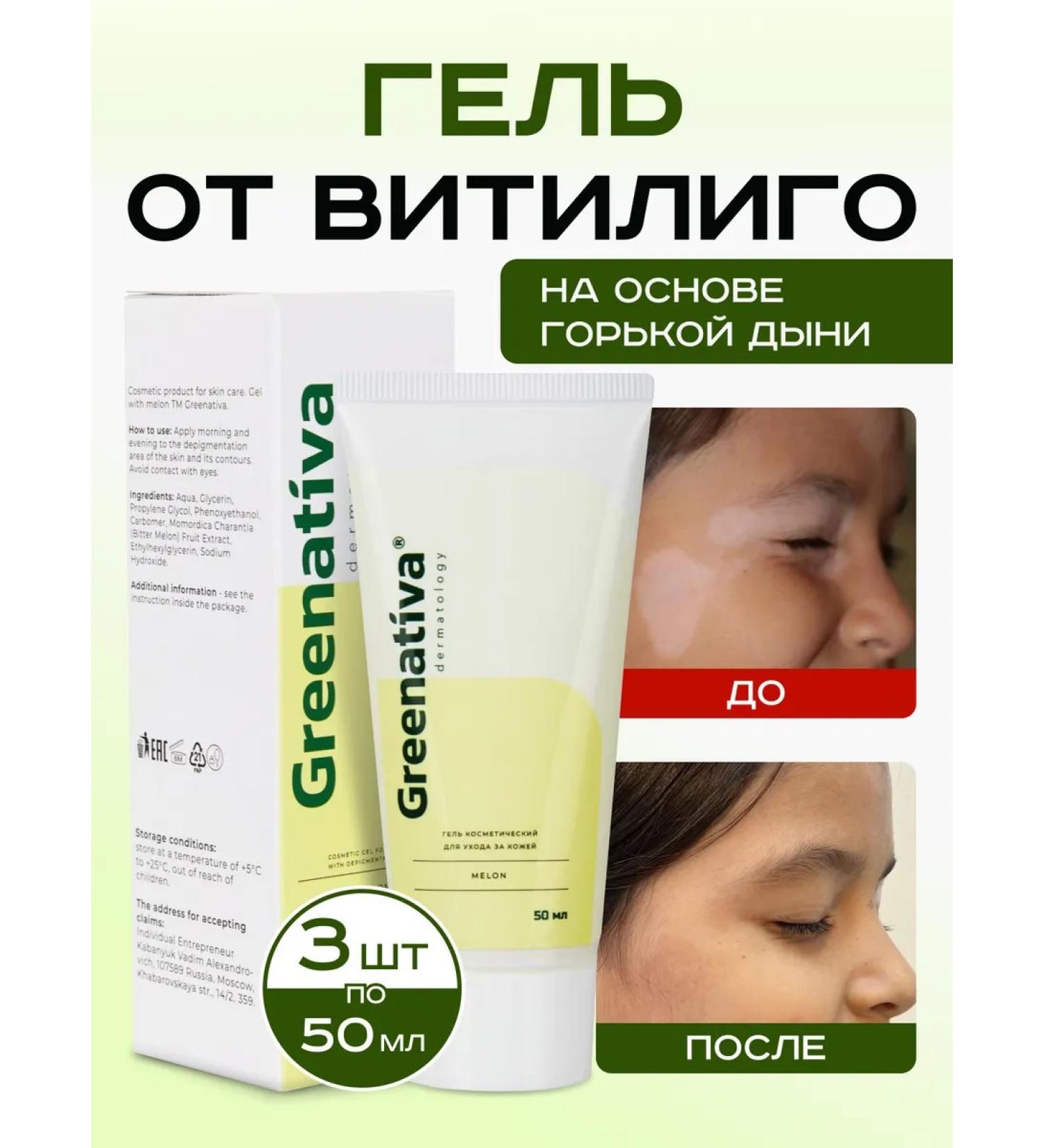 Greenativa Gel from the vitiligo of white skin spots - Buy Online on GoSupps.com