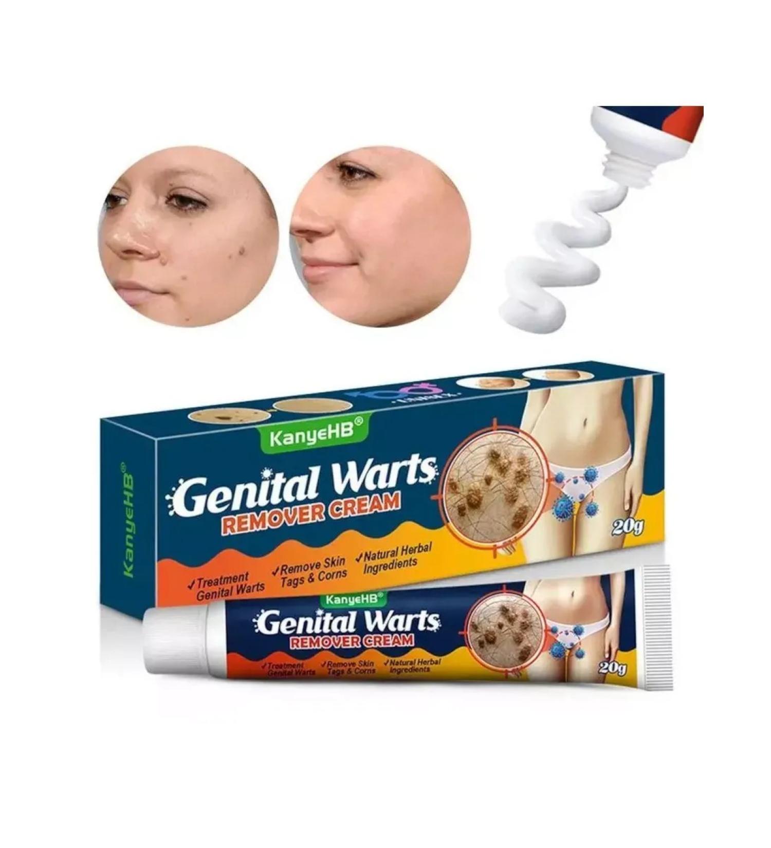 DS Health Cream for removing moles and warts 20 g