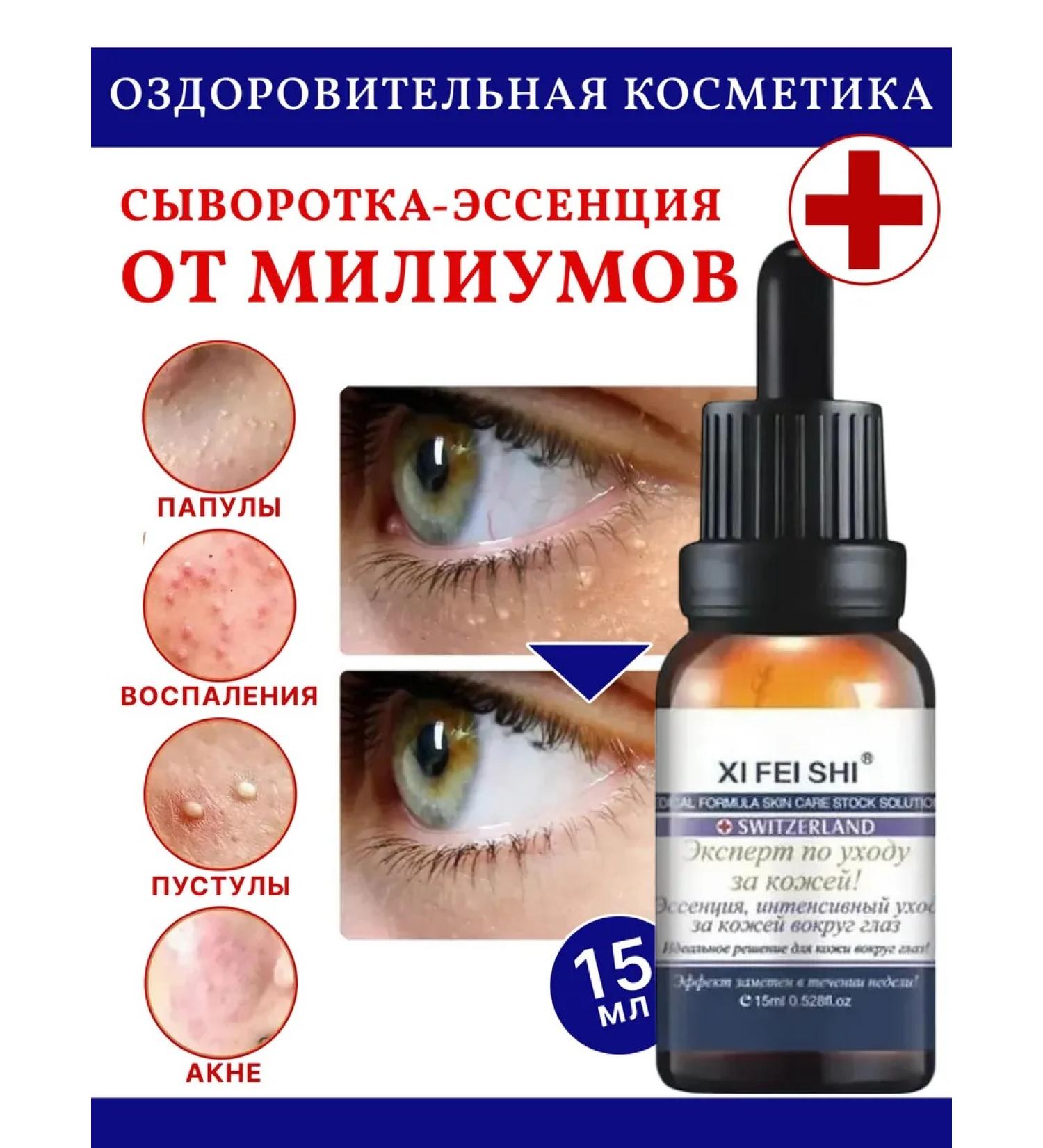 ZaKrasoty Serum from milias on the skin around the eyes - Buy Online on GoSupps.com