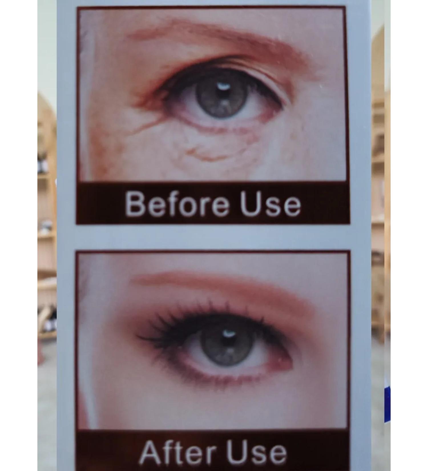 Melkonyan brand Against the wrinkles of serum