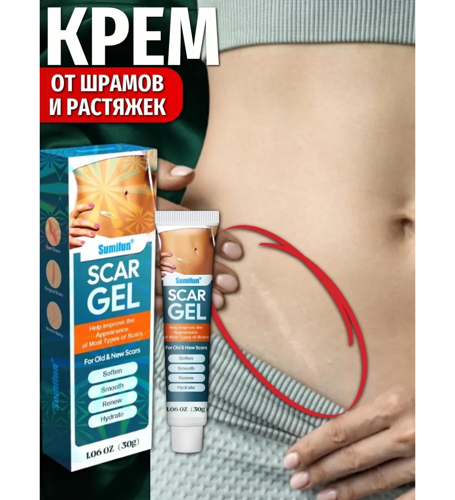 AlMaxBar Skin cream from scars - stretch marks and scars - Buy Online on GoSupps.com