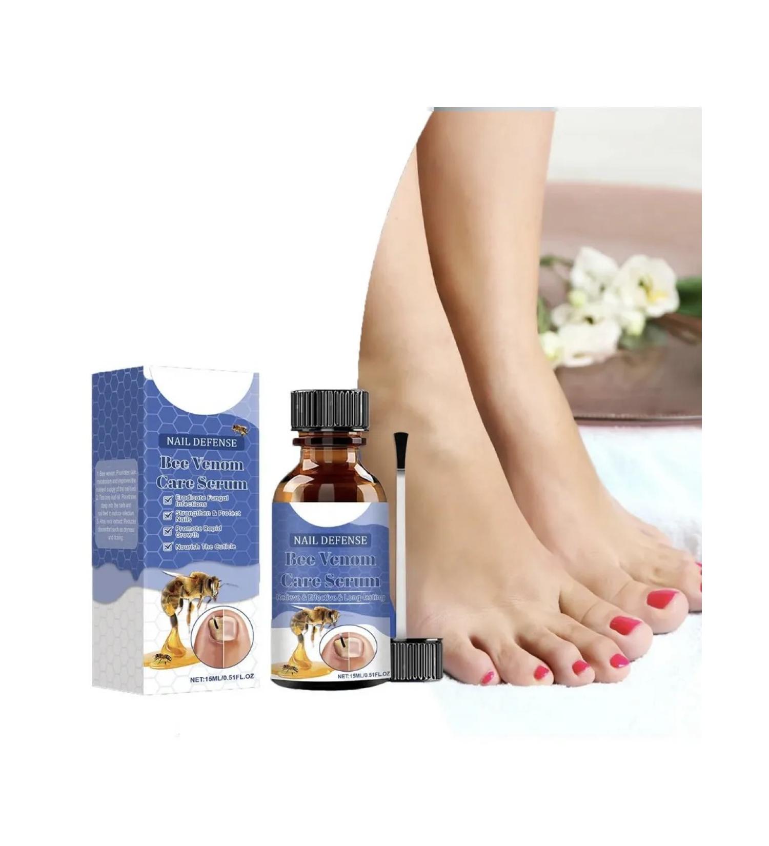 Remedy for nail fungus on the arms and legs 15 ml - Buy Online on GoSupps.com