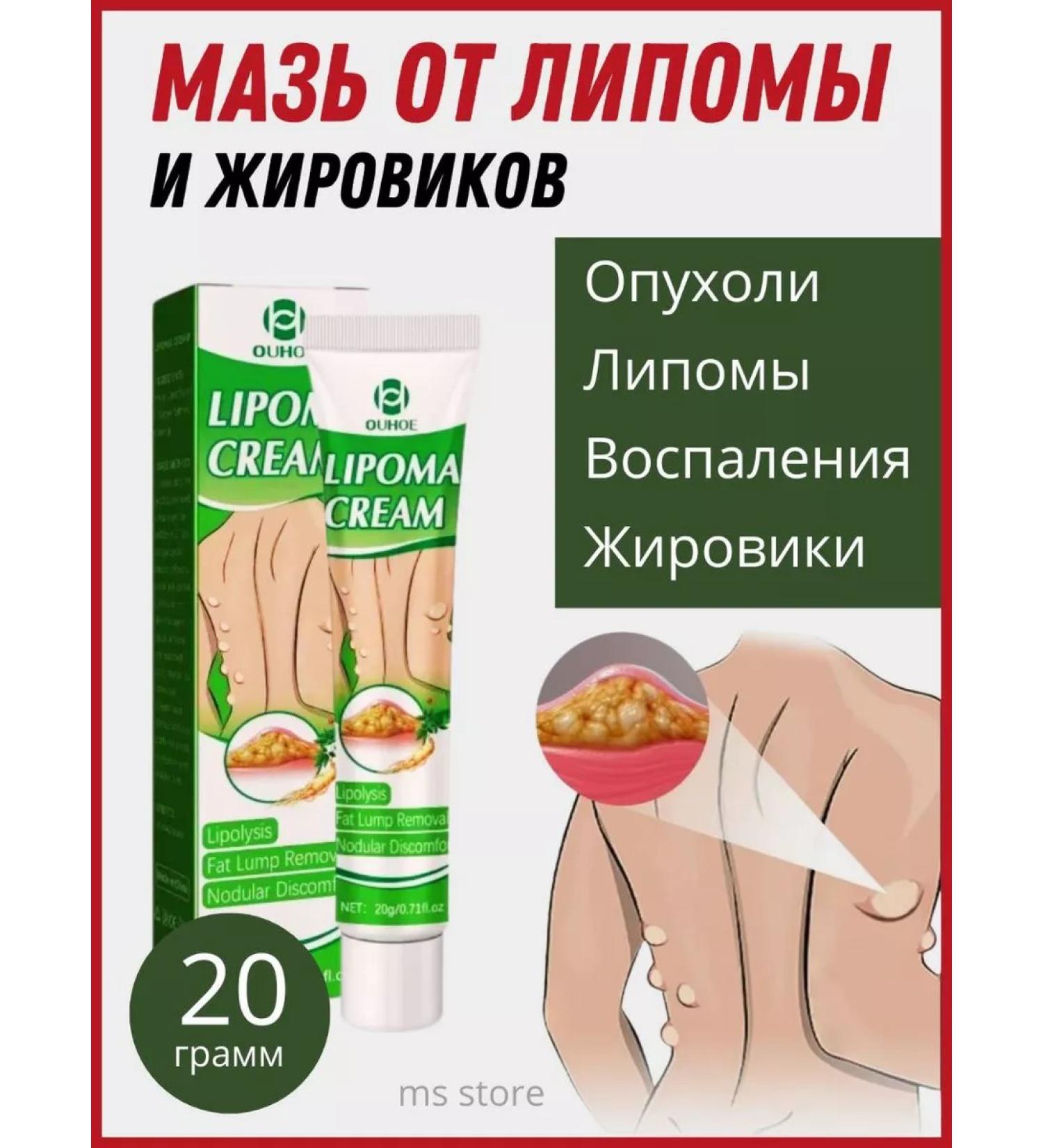 TOWN UDOKI 06 Ointment from Lipoma and Girovikov 20 g - Buy Online on GoSupps.com
