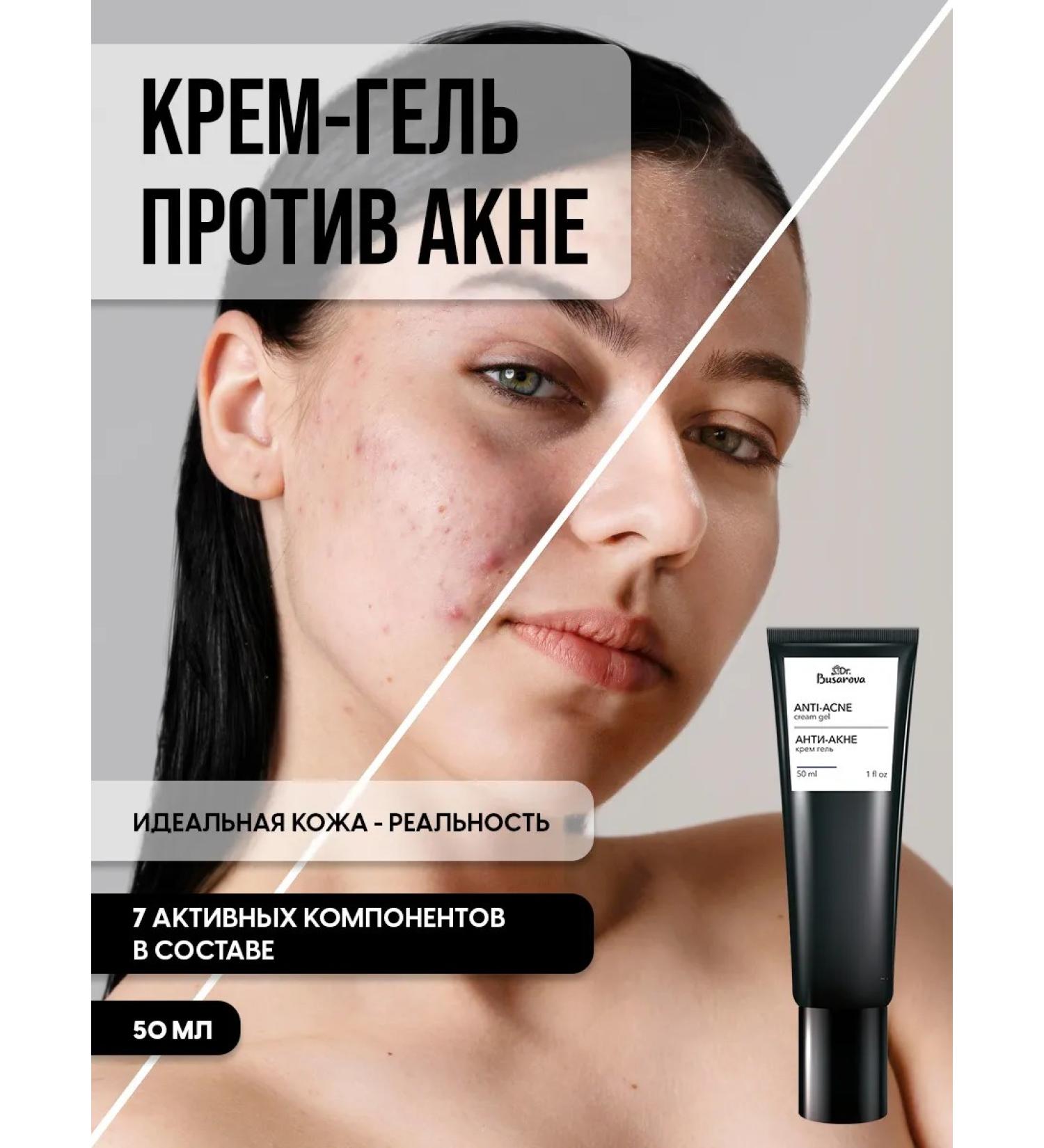 Busarova Cosmetics Cream for problem skin from acne and acne on the face and body - Buy Online on GoSupps.com