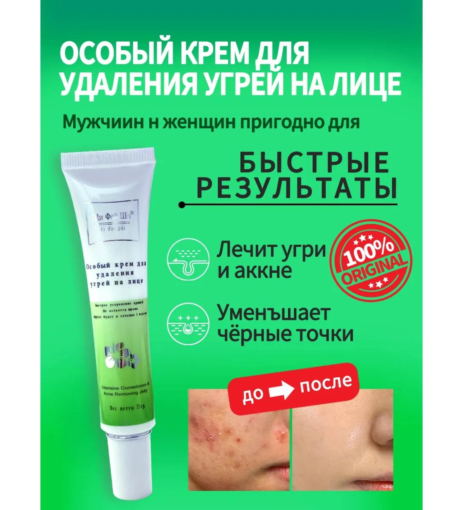 world of beauty Acne cream - acne and acne on the face and body - Buy Online on GoSupps.com