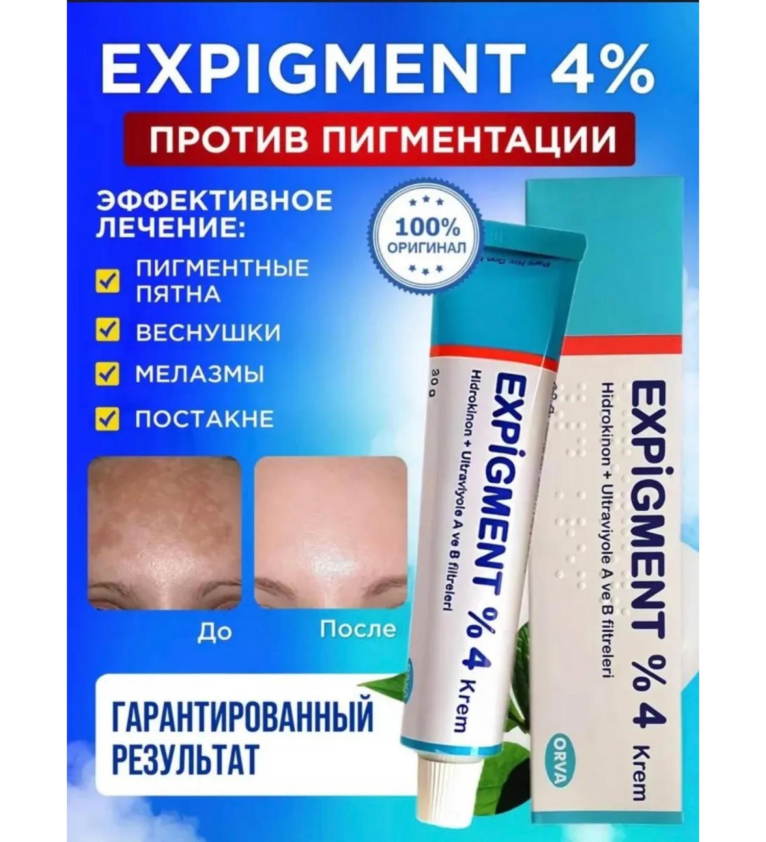 Orva Cream against age spots and freckles Expigment 4% - Buy Online on GoSupps.com