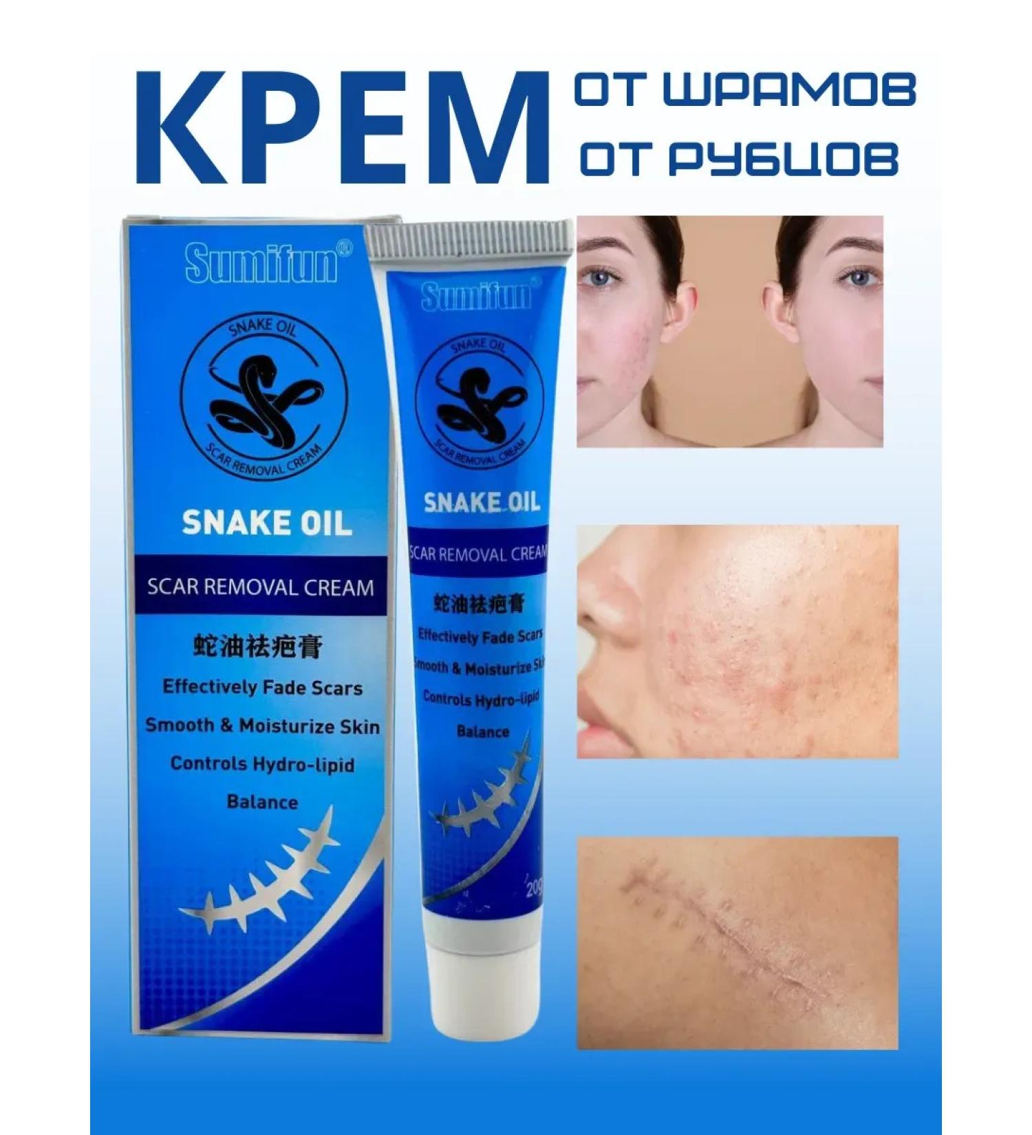 CSS Ointment from scars and scars from stretch marks - Buy Online on GoSupps.com