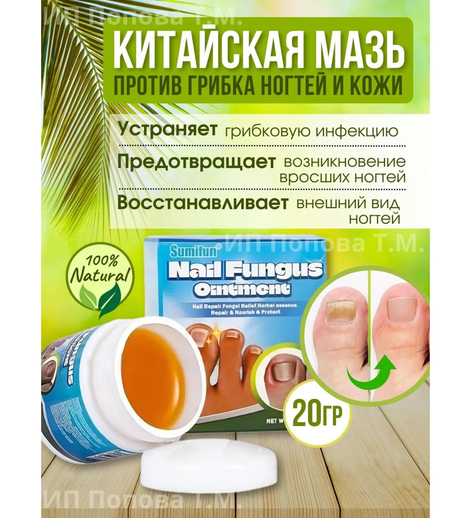 TOPSHOP Chinese remedy for nail fungus 20 g