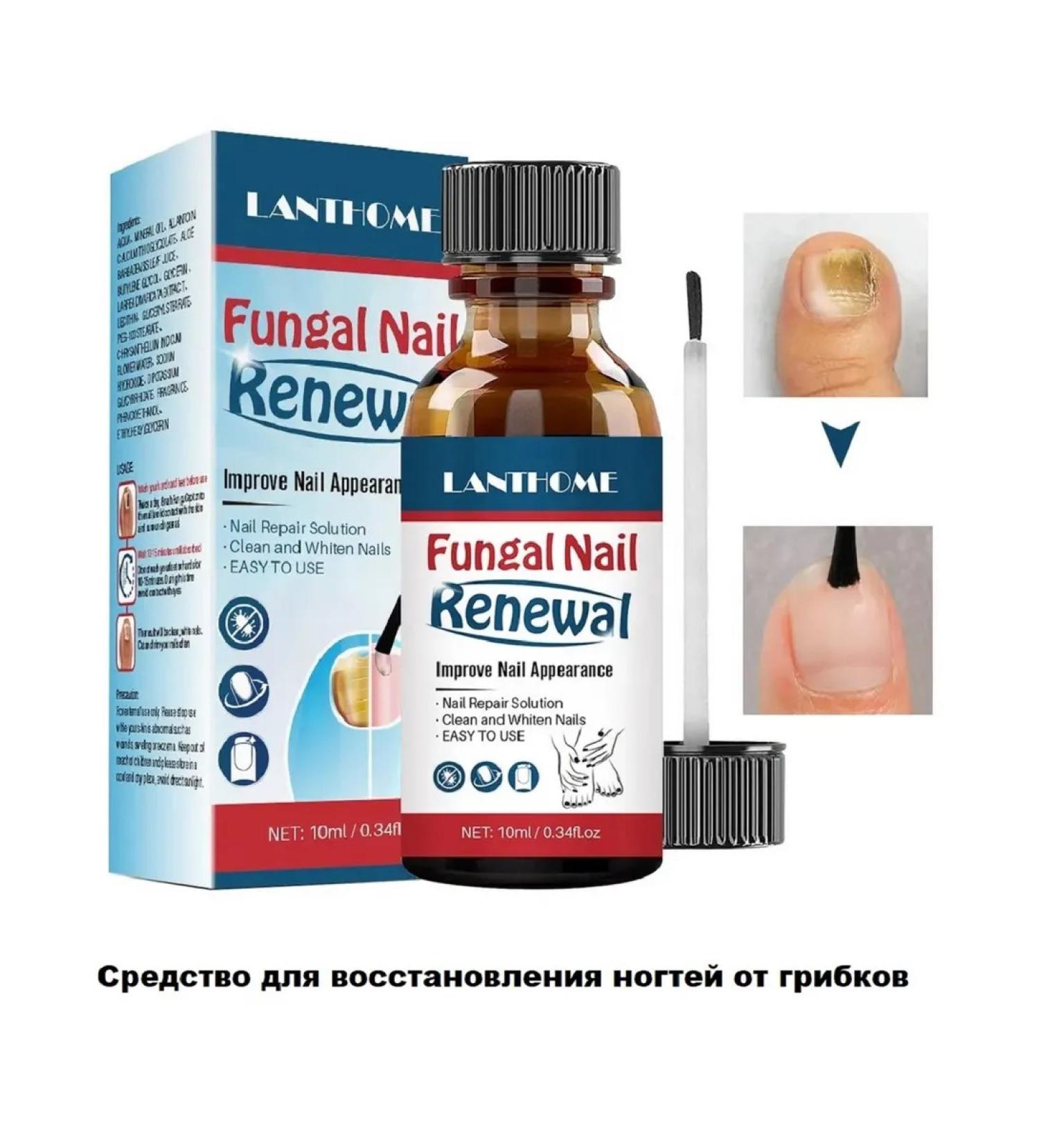 Antifungal agent for therapeutic restoration of nails - Buy Online on GoSupps.com