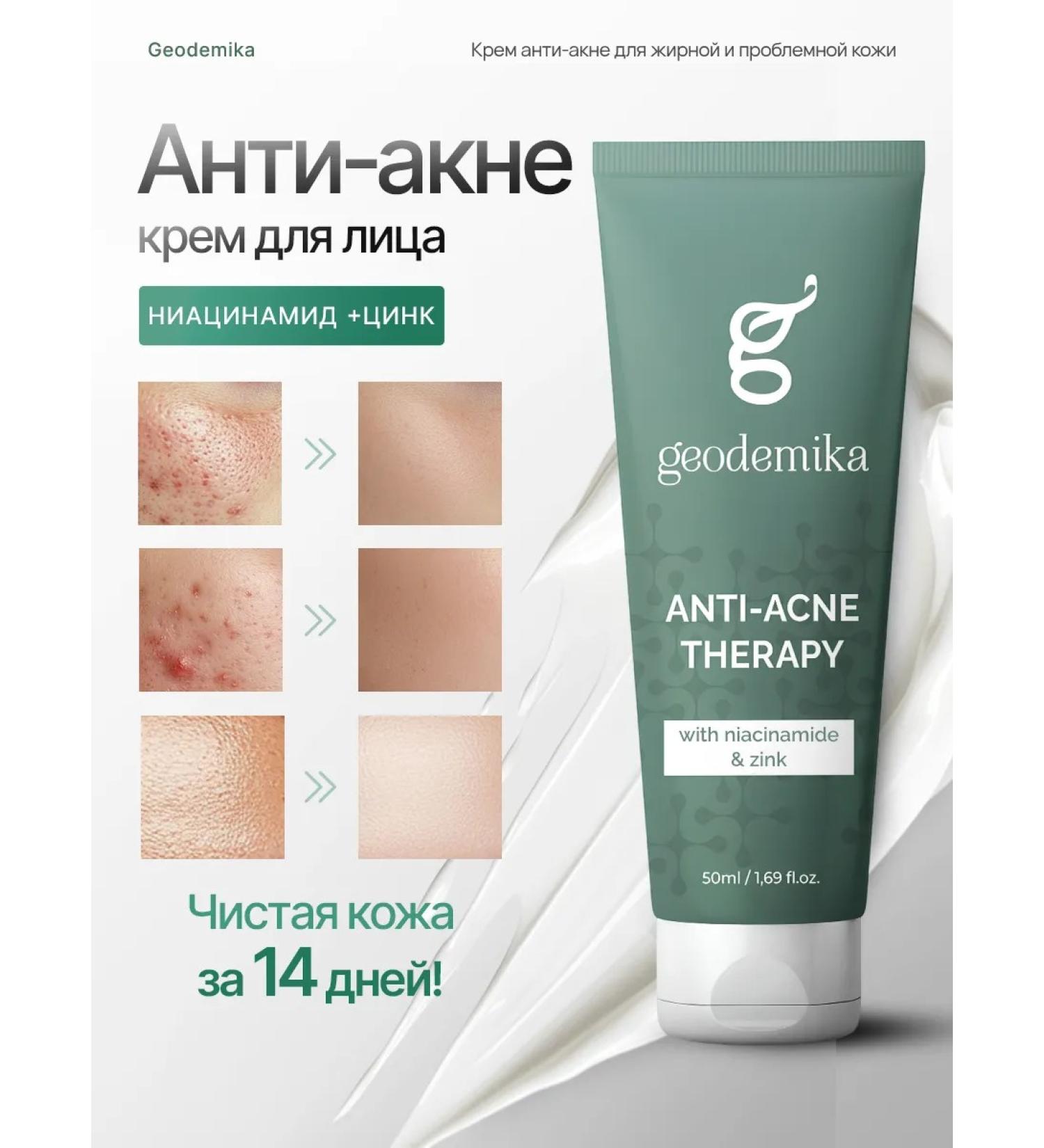 Geodemics Cream for acne zinc and niacinamide 50ml - Buy Online on GoSupps.com