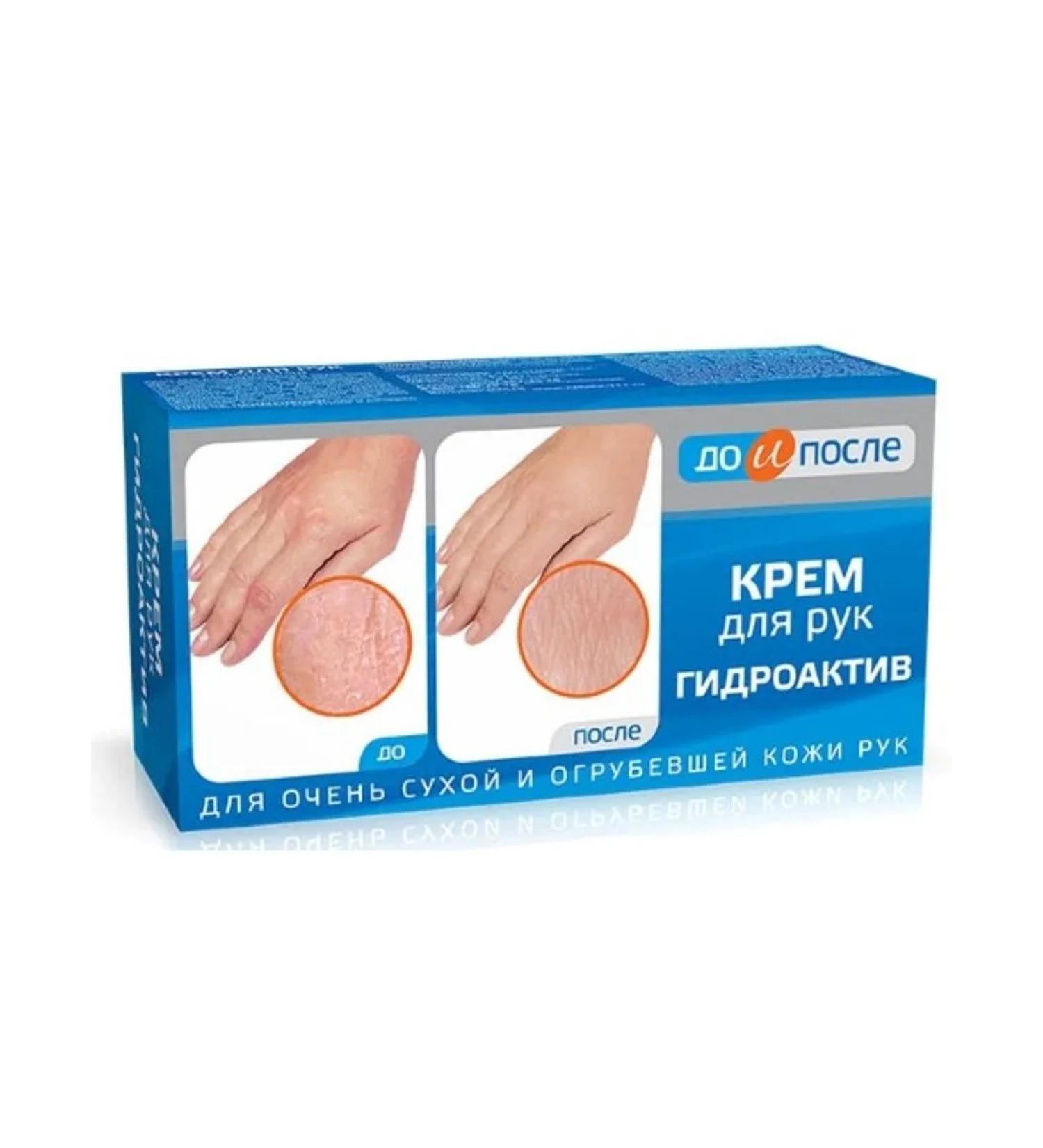 BEFORE AND AFTER Cream Hydroctic d hands 100ml