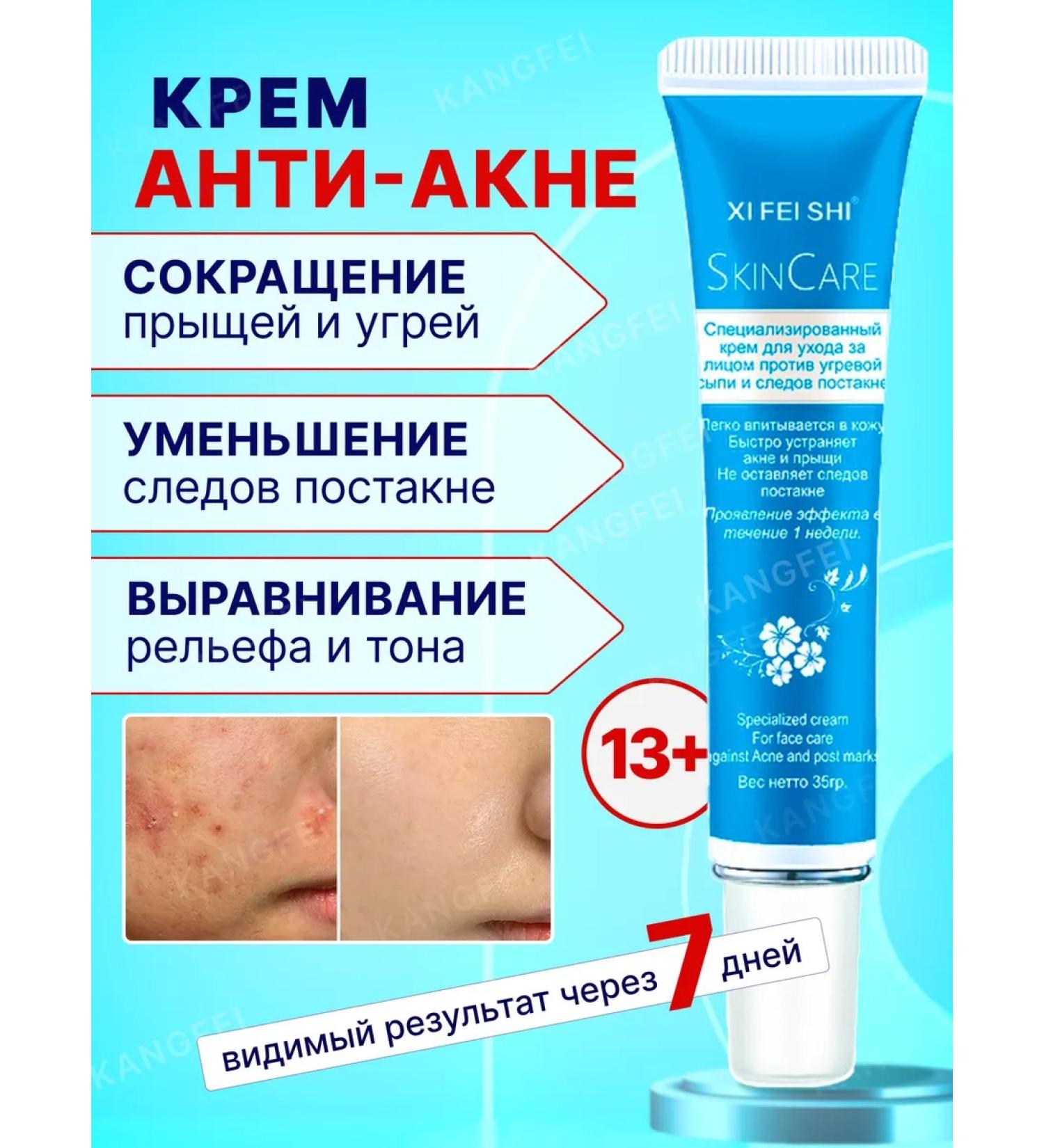 KANGFEI Acne cream post -acne on the face and body - Buy Online on GoSupps.com