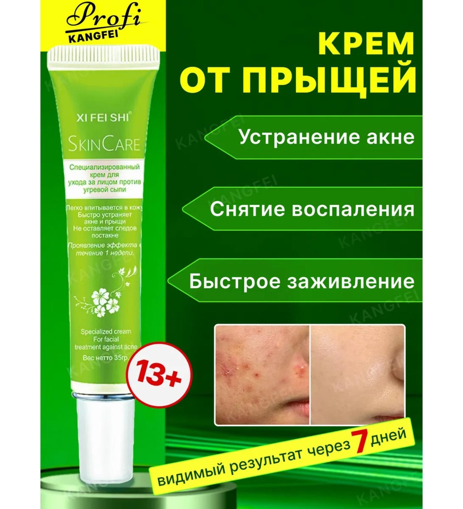 KANGFEI Acne cream and acne for the face and body - Buy Online on GoSupps.com