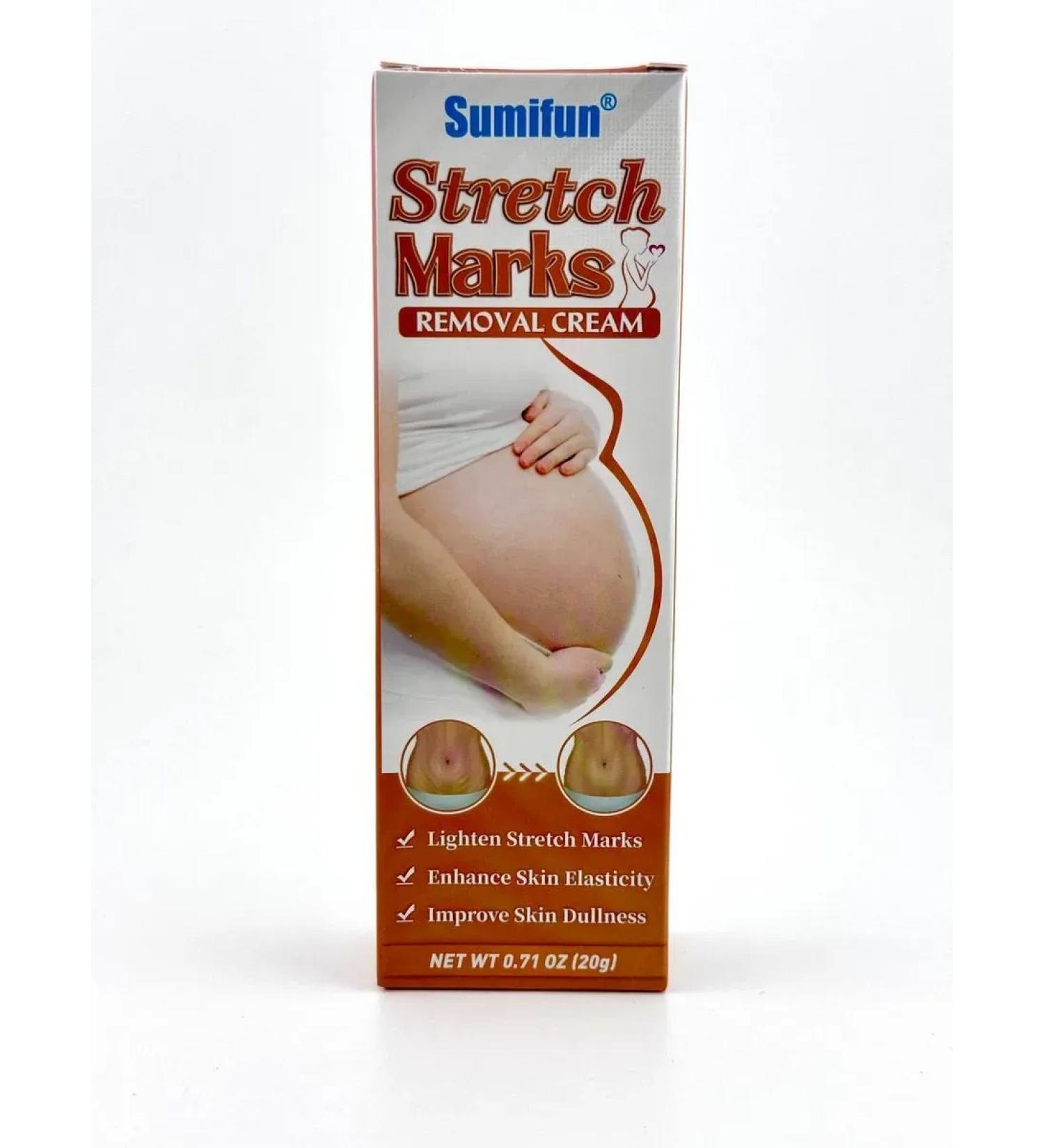 UkToktogulova Pregnant stretch marks - Buy Online on GoSupps.com