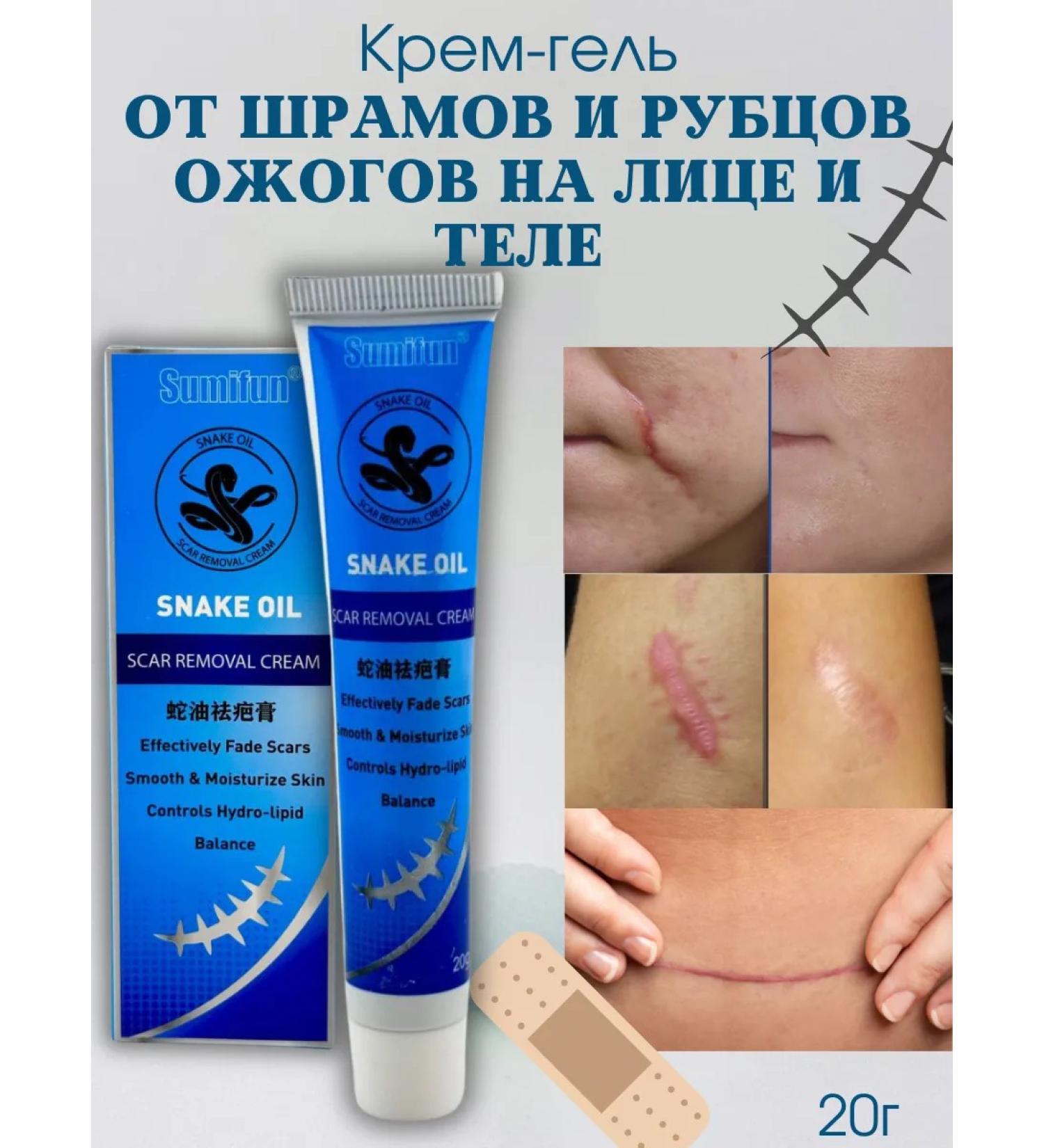 New suite Gel from scars and scars touched burns on the face and body - Buy Online on GoSupps.com
