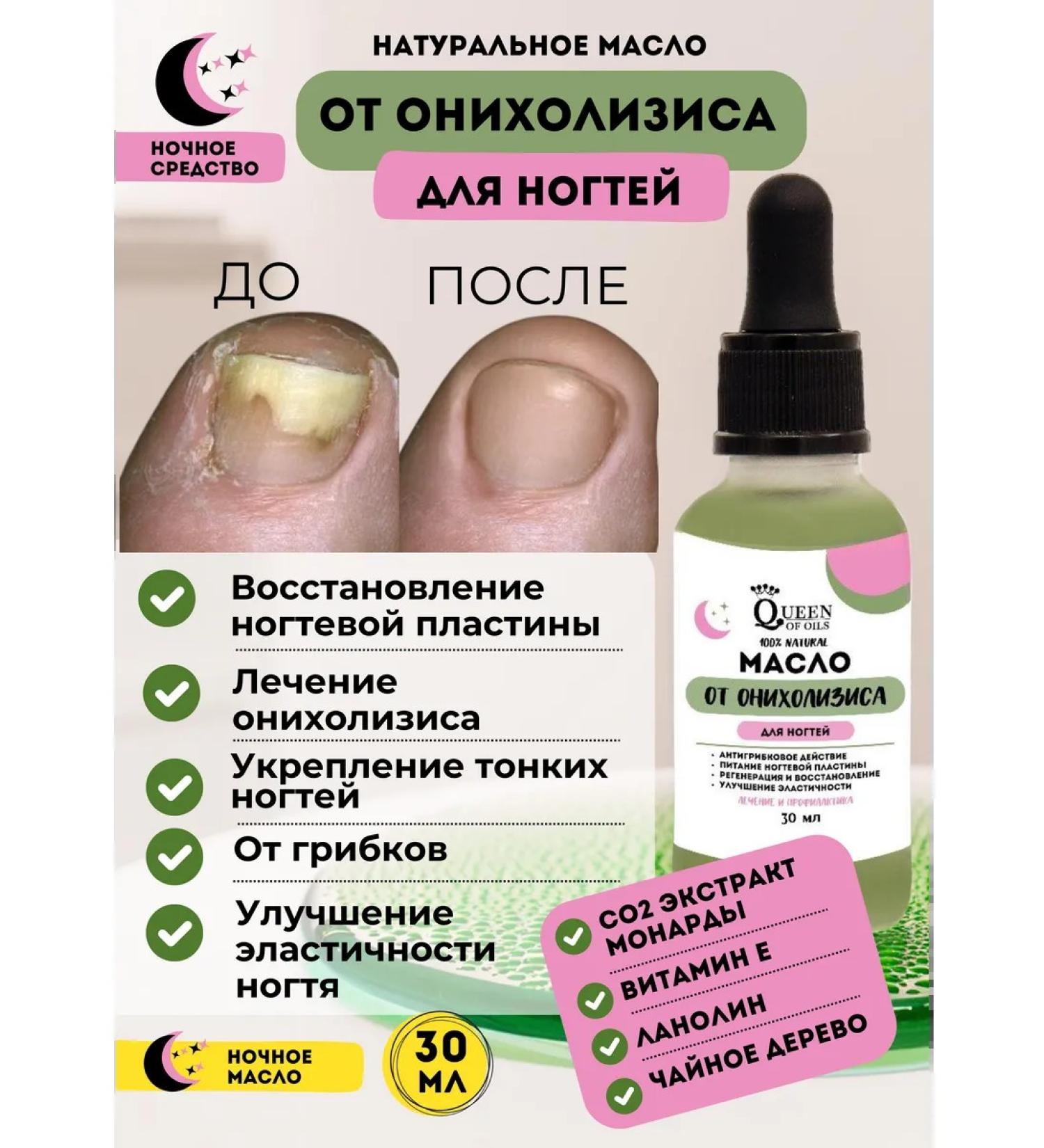 Queen of Oils Restoring oil from onycholysis of nail fungus - Buy Online on GoSupps.com