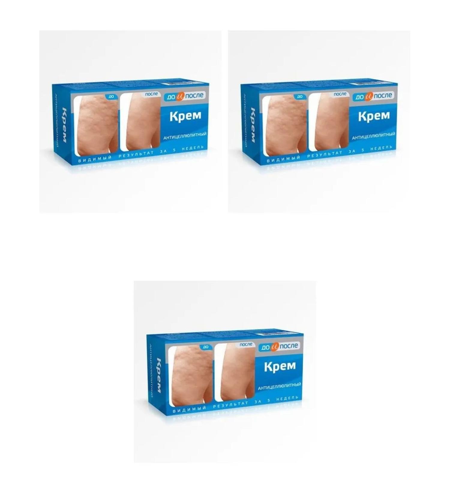 Before and After Anti -cellulite cream 100ml 3 pcs