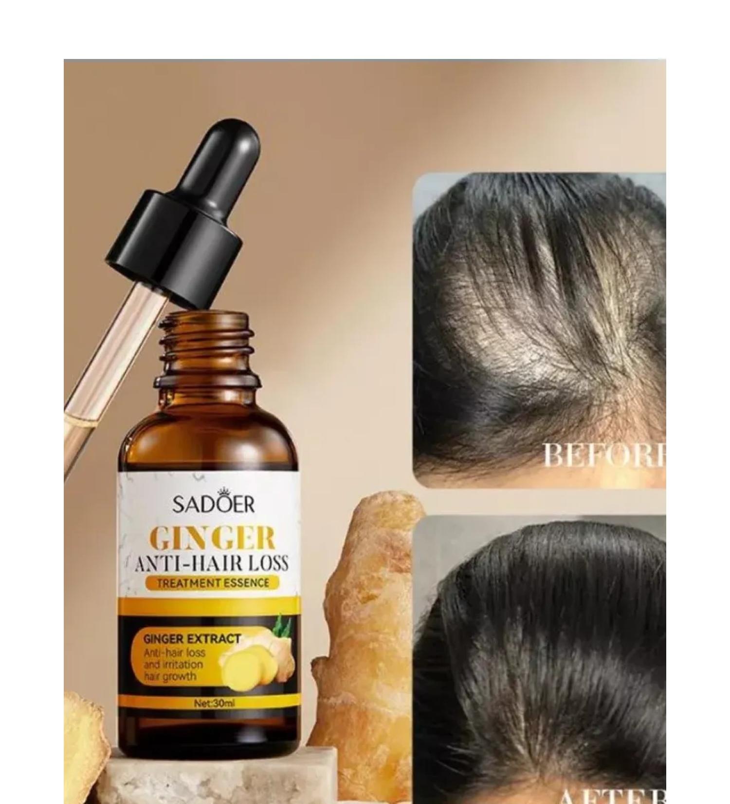 FOR HAIR Infuted serum from hair loss - Buy Online on GoSupps.com