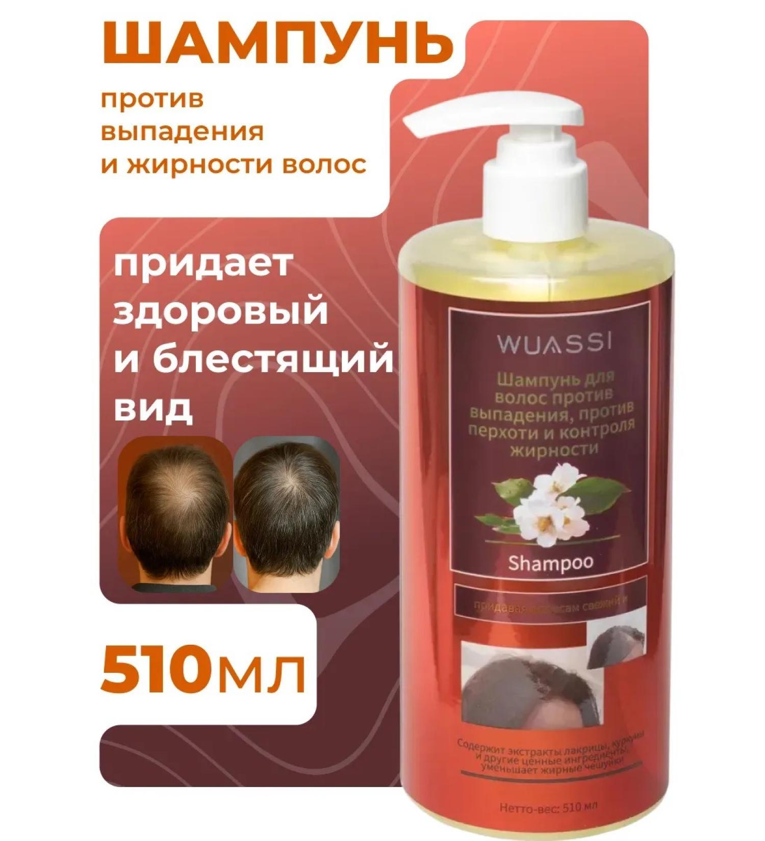 TopStore99 Shampoo against hair loss and oily - Buy Online on GoSupps.com