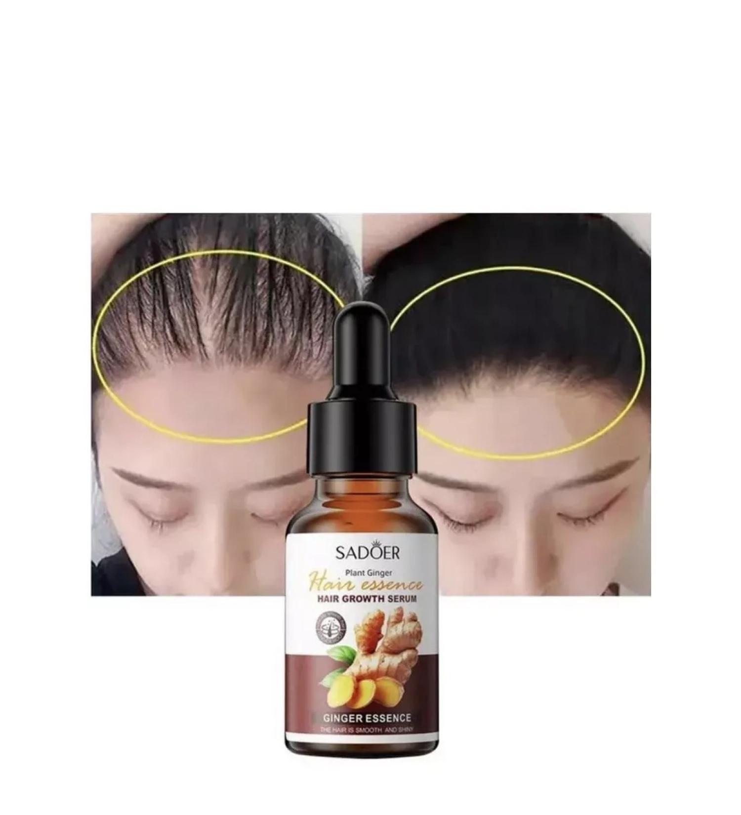 Box Hair growth oil