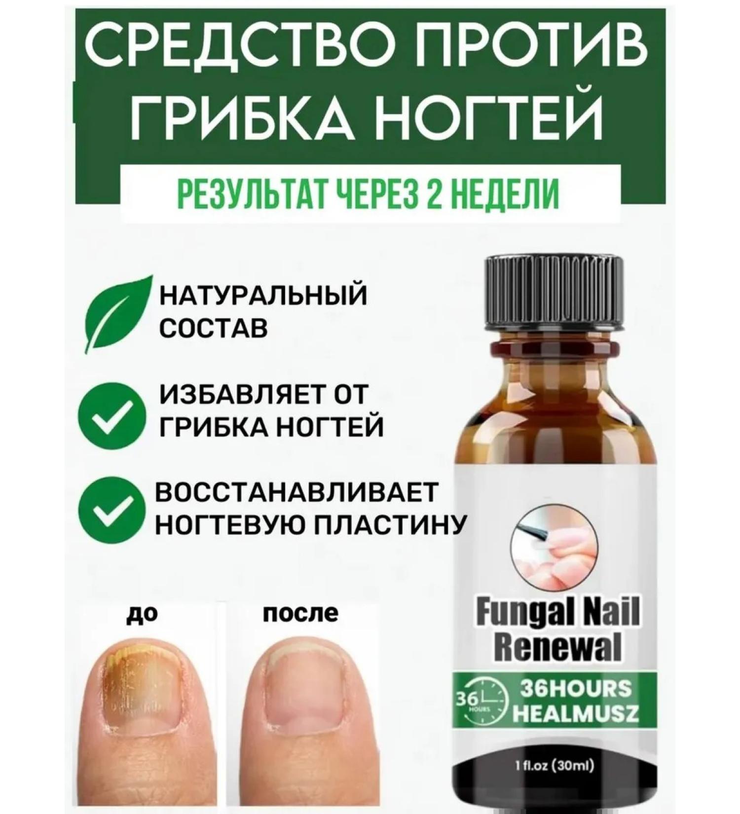 cream Chinese remedy for nail fungus 30 ml - Buy Online on GoSupps.com