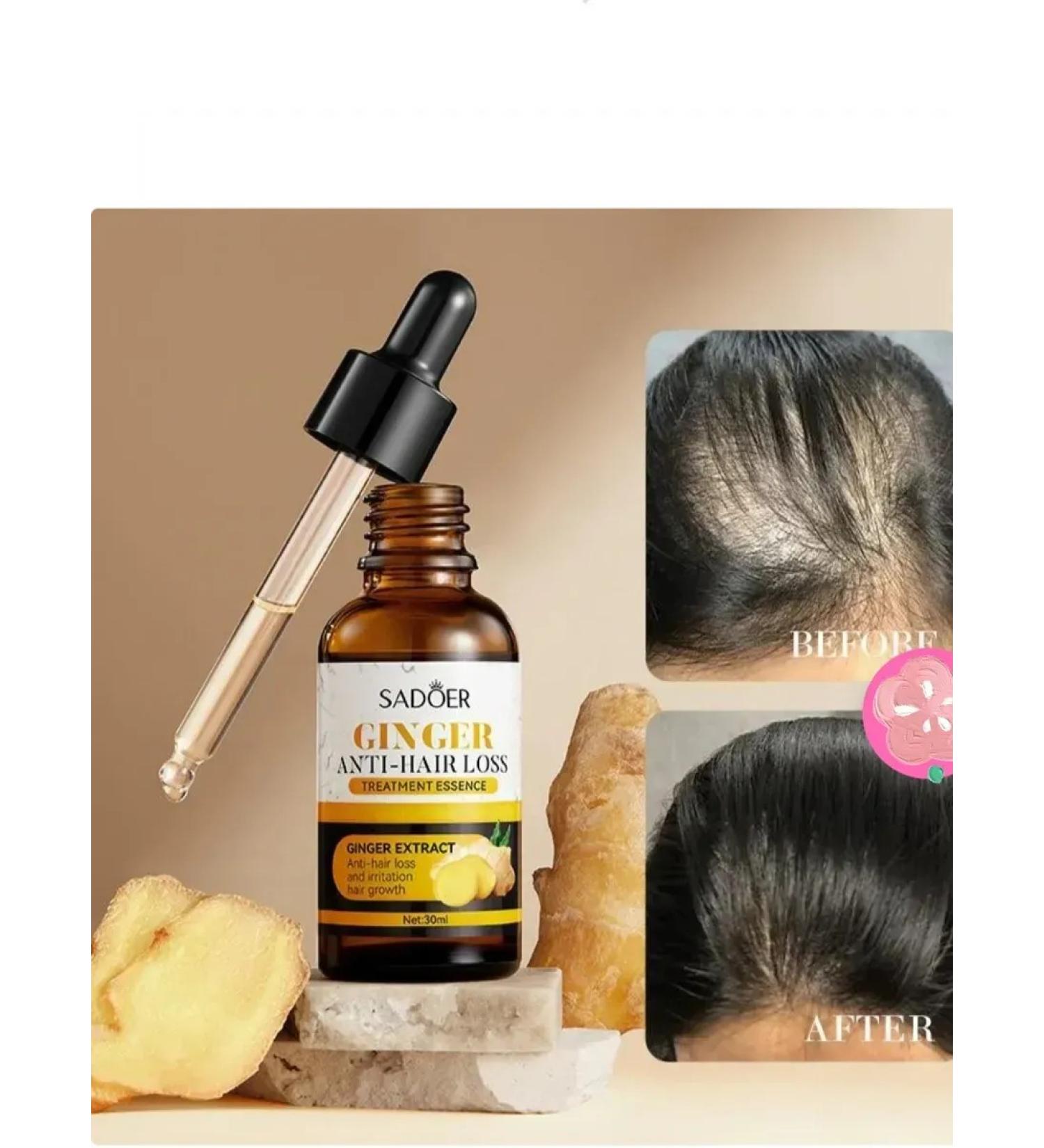 MELUX Hair loss Ginger Anti - Buy Online on GoSupps.com