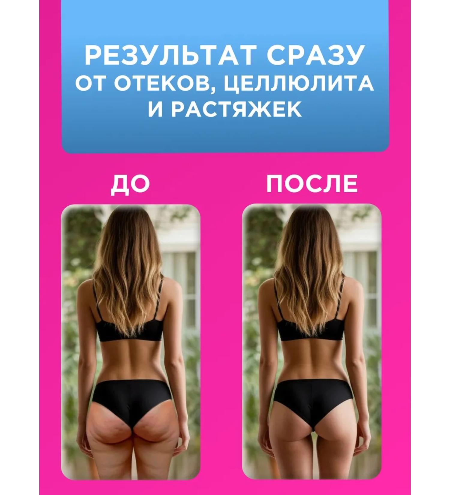 lvcos Anti -cellulite cream for weight loss - Buy Online on GoSupps.com