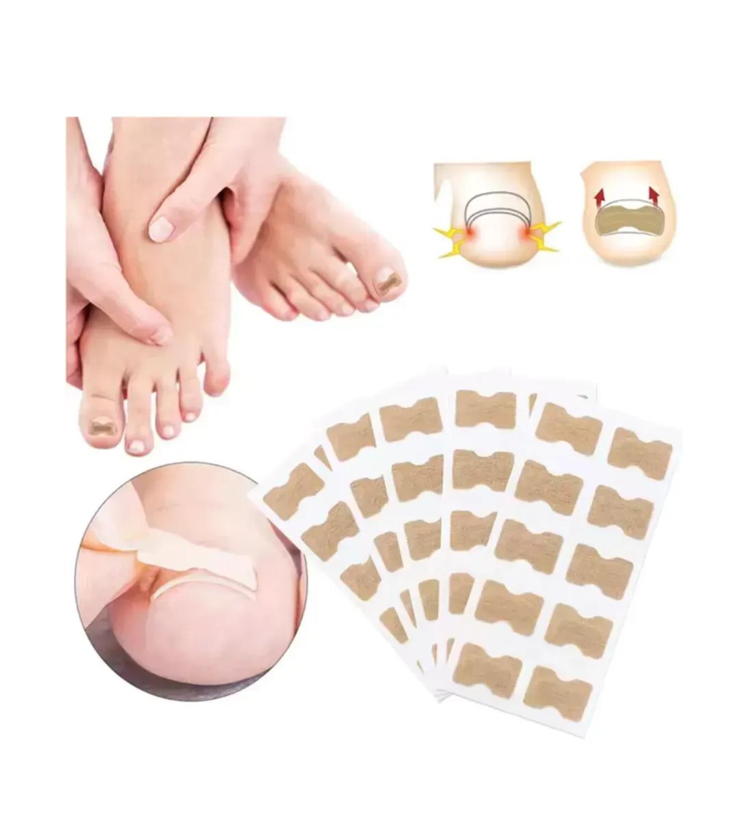 Patch from ingrown nails - Buy Online on GoSupps.com