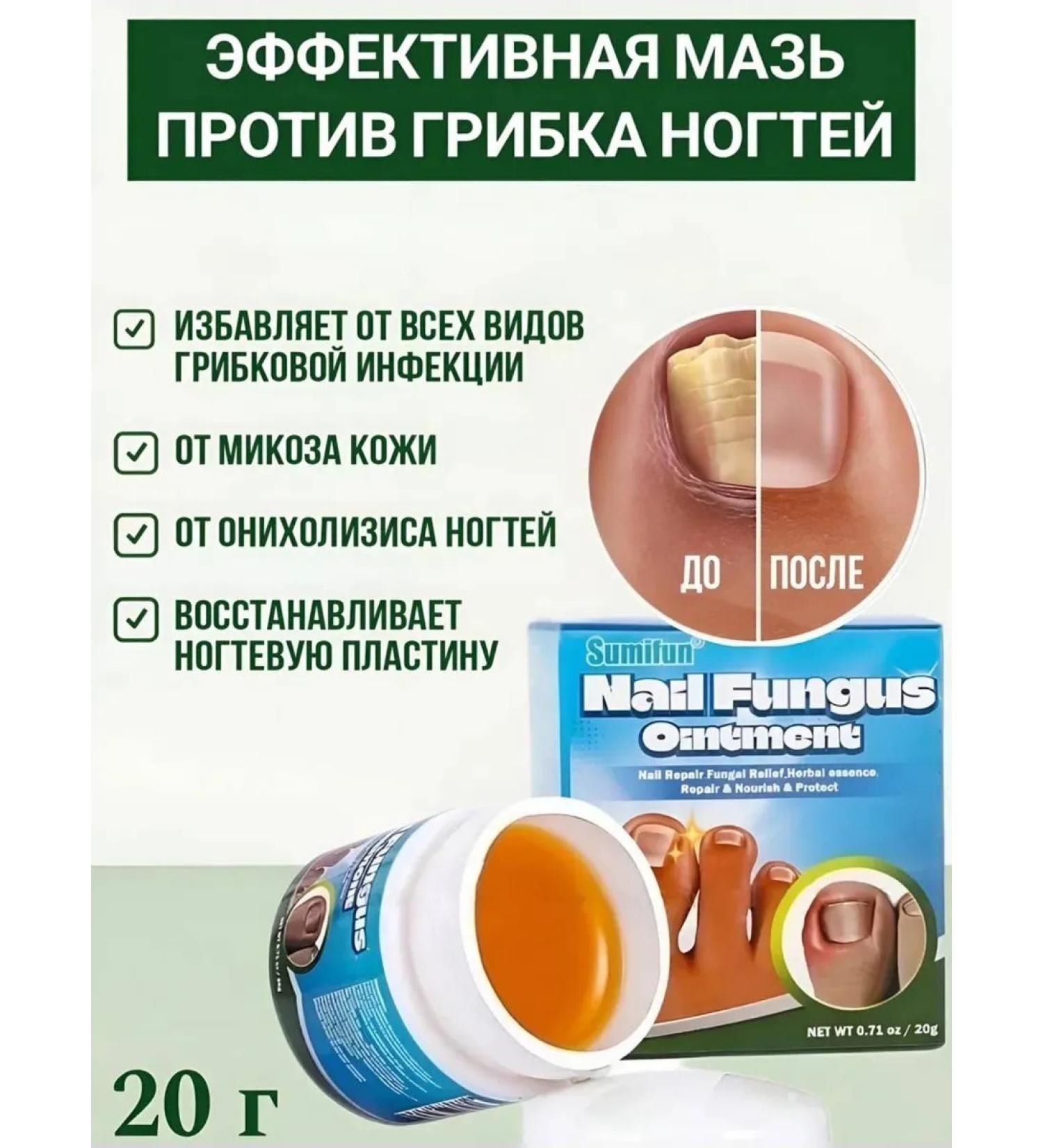 Ointment Chinese remedy for nail fungus 20 g - Buy Online on GoSupps.com