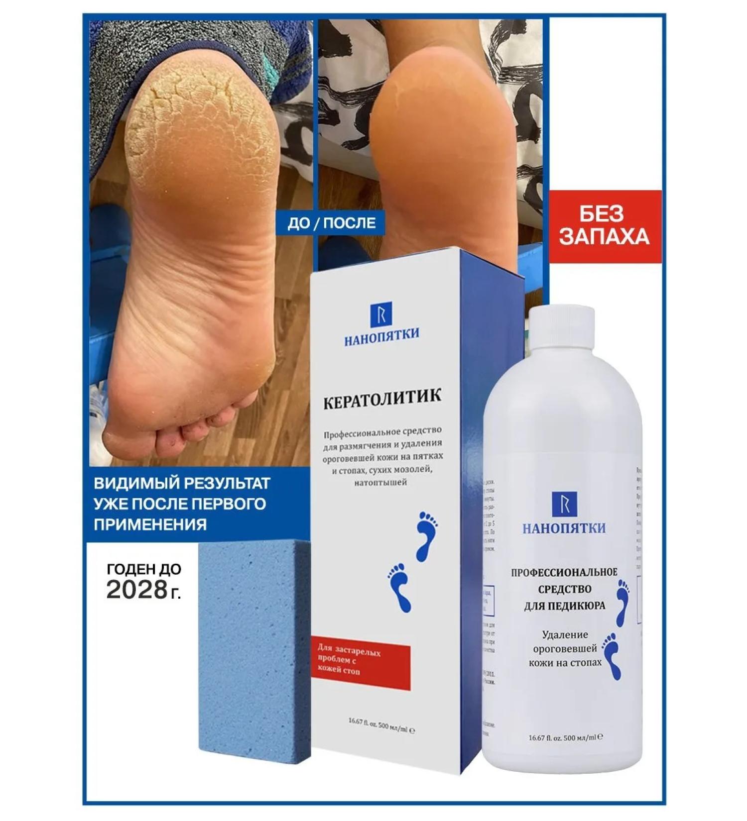 NANO-HEELS Pedicure remedy for rough skin on heels - Buy Online on GoSupps.com