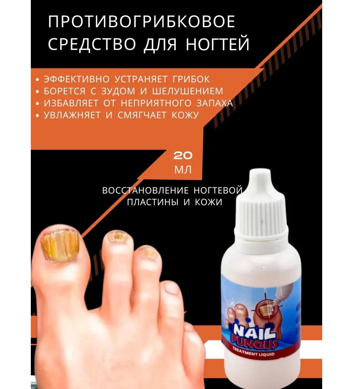 Ouch Remedy for nail fungus and from odor odors effective - Buy Online on GoSupps.com