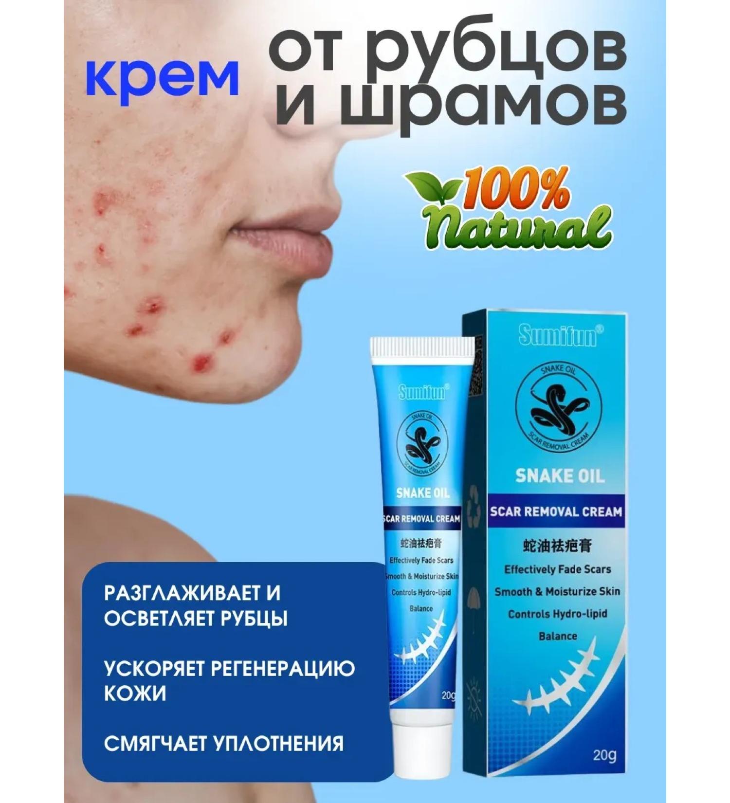 NazDiamo Cream from scars of scars from acne with snake oil - Buy Online on GoSupps.com