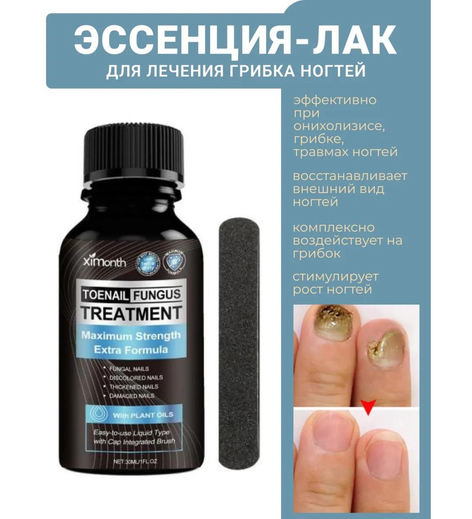 WOW heels Nail fungus agent 30 ml - Buy Online on GoSupps.com