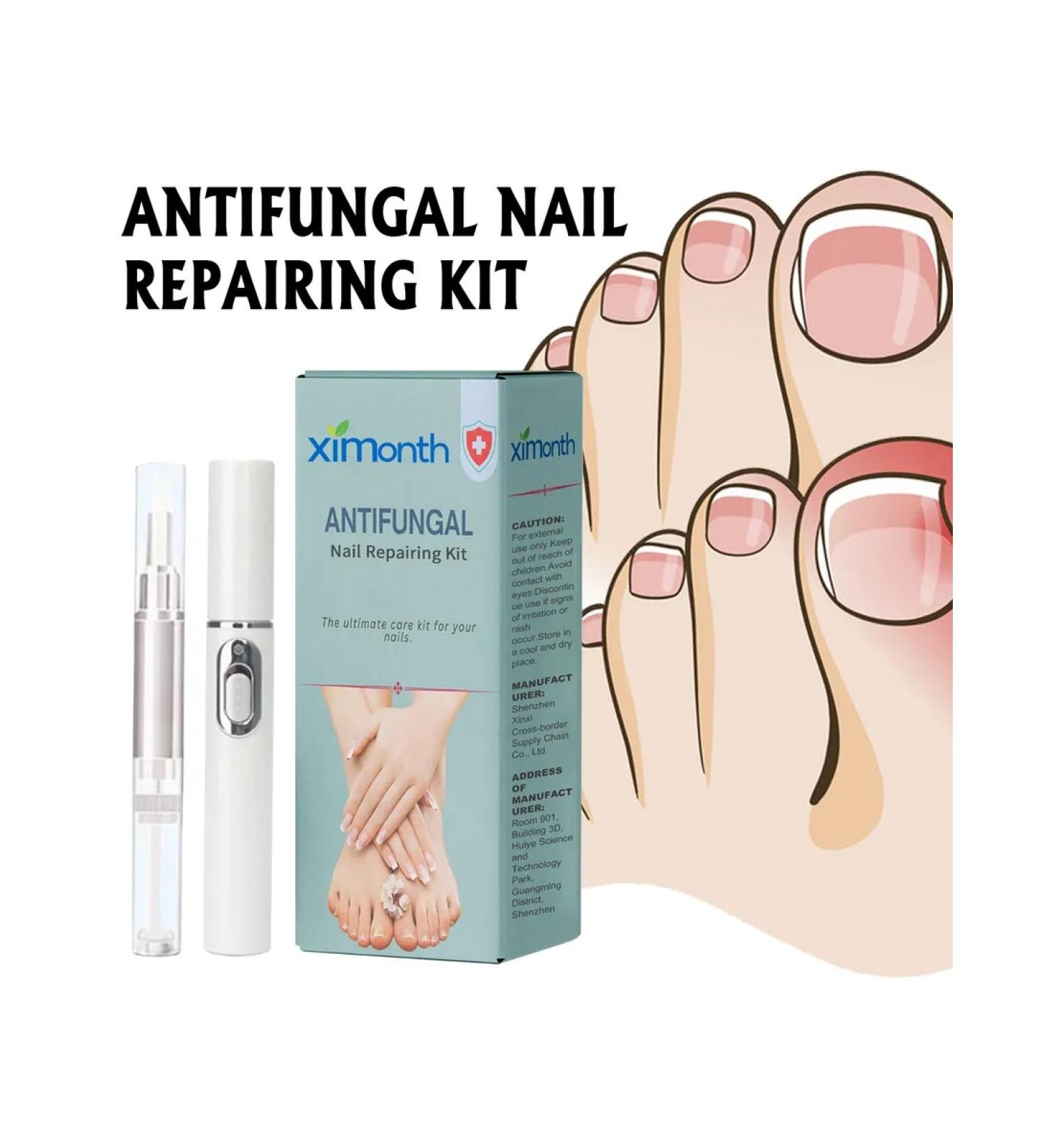 Ximonth antifungal set for nail care - Buy Online on GoSupps.com