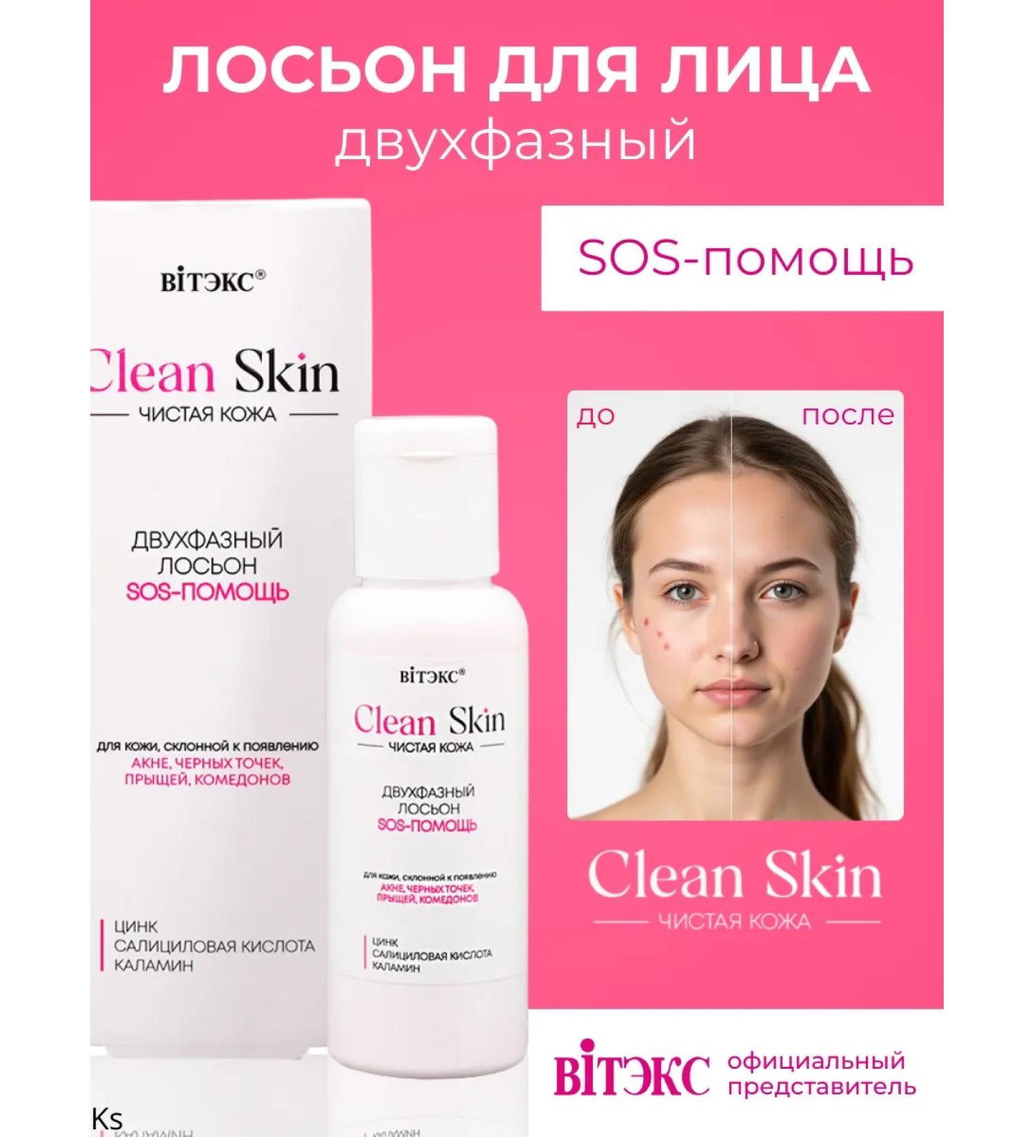 Vitex Two-phase sos-help lotion with zinc pure skin
