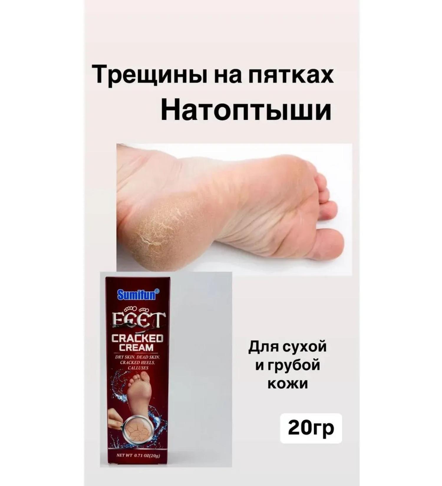 SMka Foot cream from cracks and corns - Buy Online on GoSupps.com