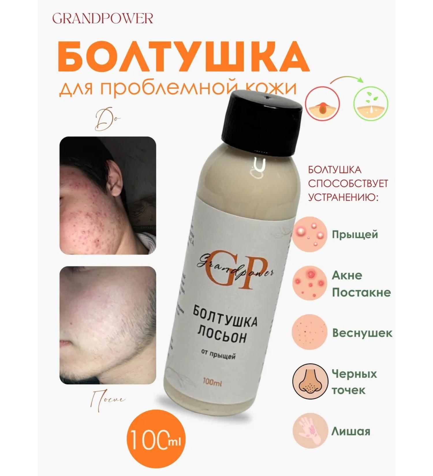 GRANDPOWER A chattering can of acne - Buy Online on GoSupps.com