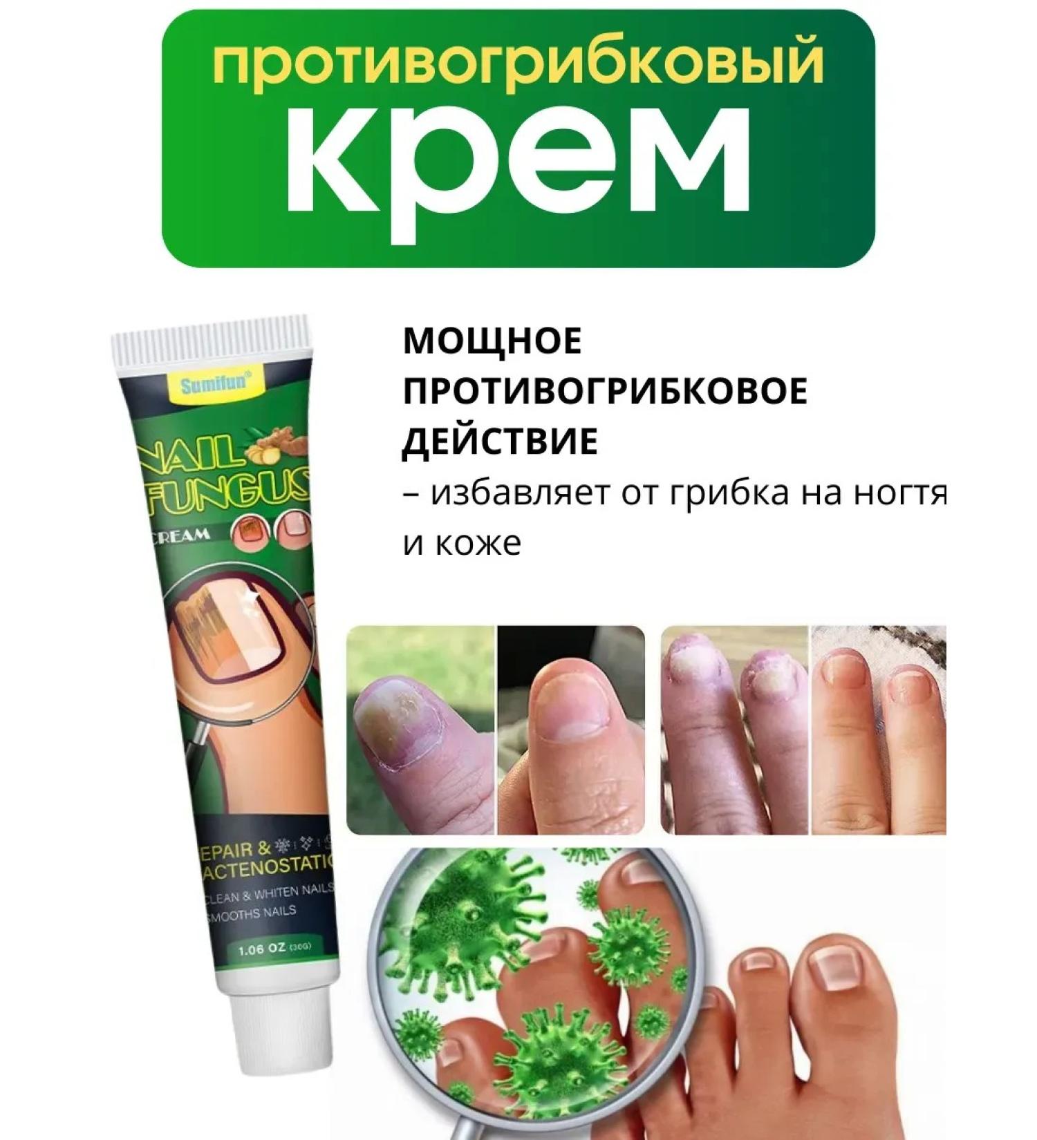 NazzSmile Chinese remedy for nail fungus treatment - Buy Online on GoSupps.com