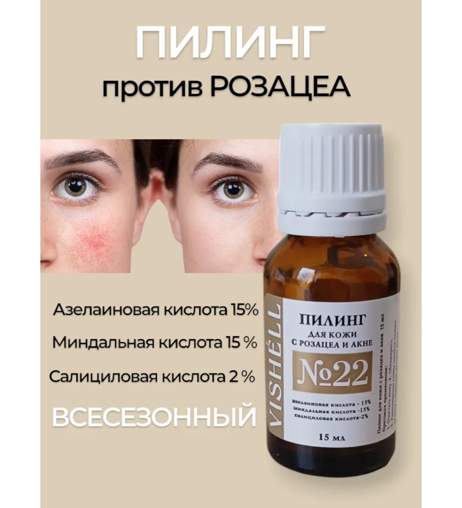 Vishell Skin peeling with rosacea and acne