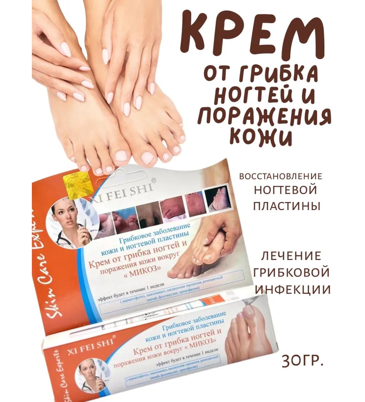 Cinquefoil Remedy for nail fungus on the legs and arms cream - Buy Online on GoSupps.com