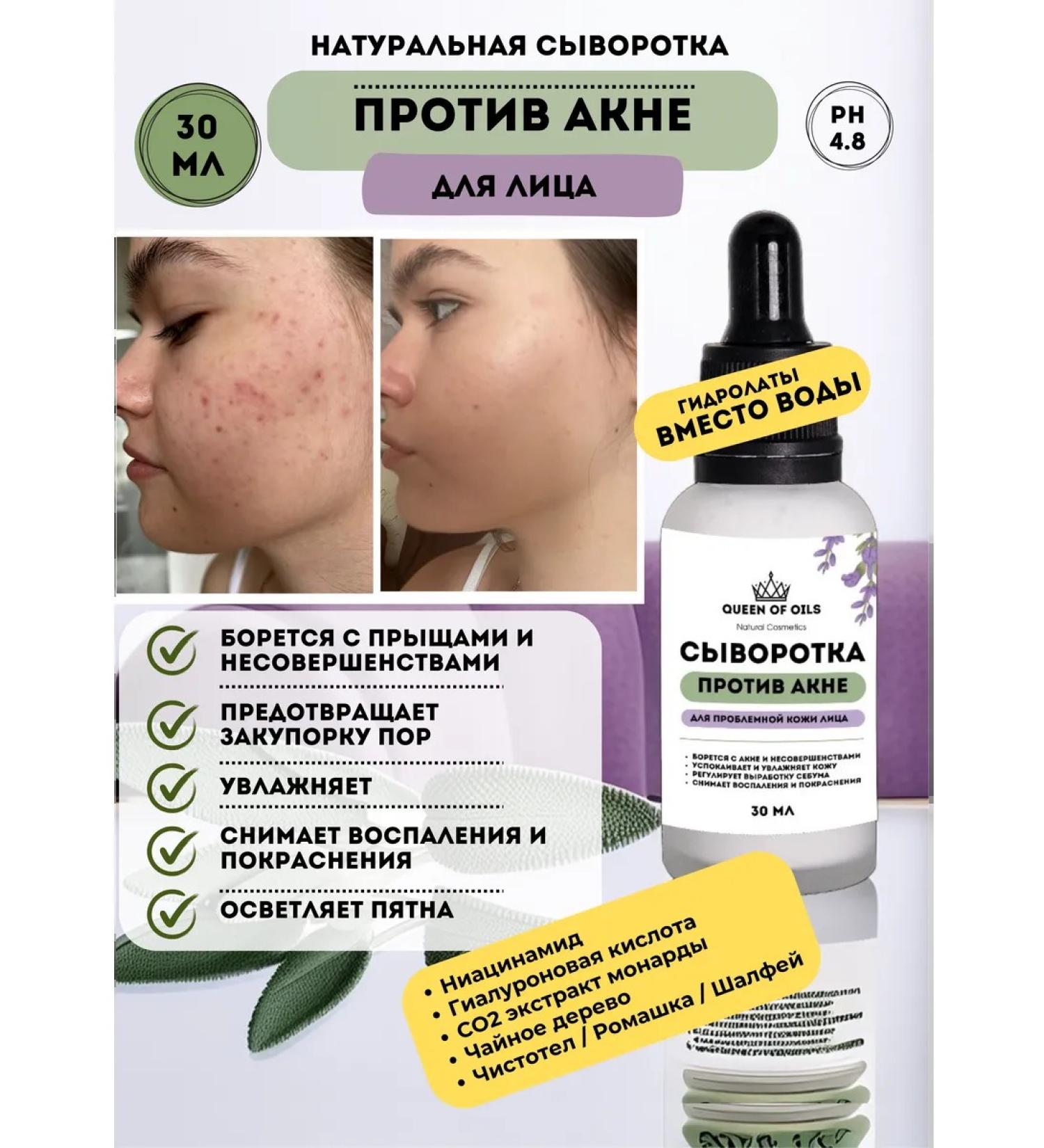 Queen of Oils Acne and acne serum - Buy Online on GoSupps.com