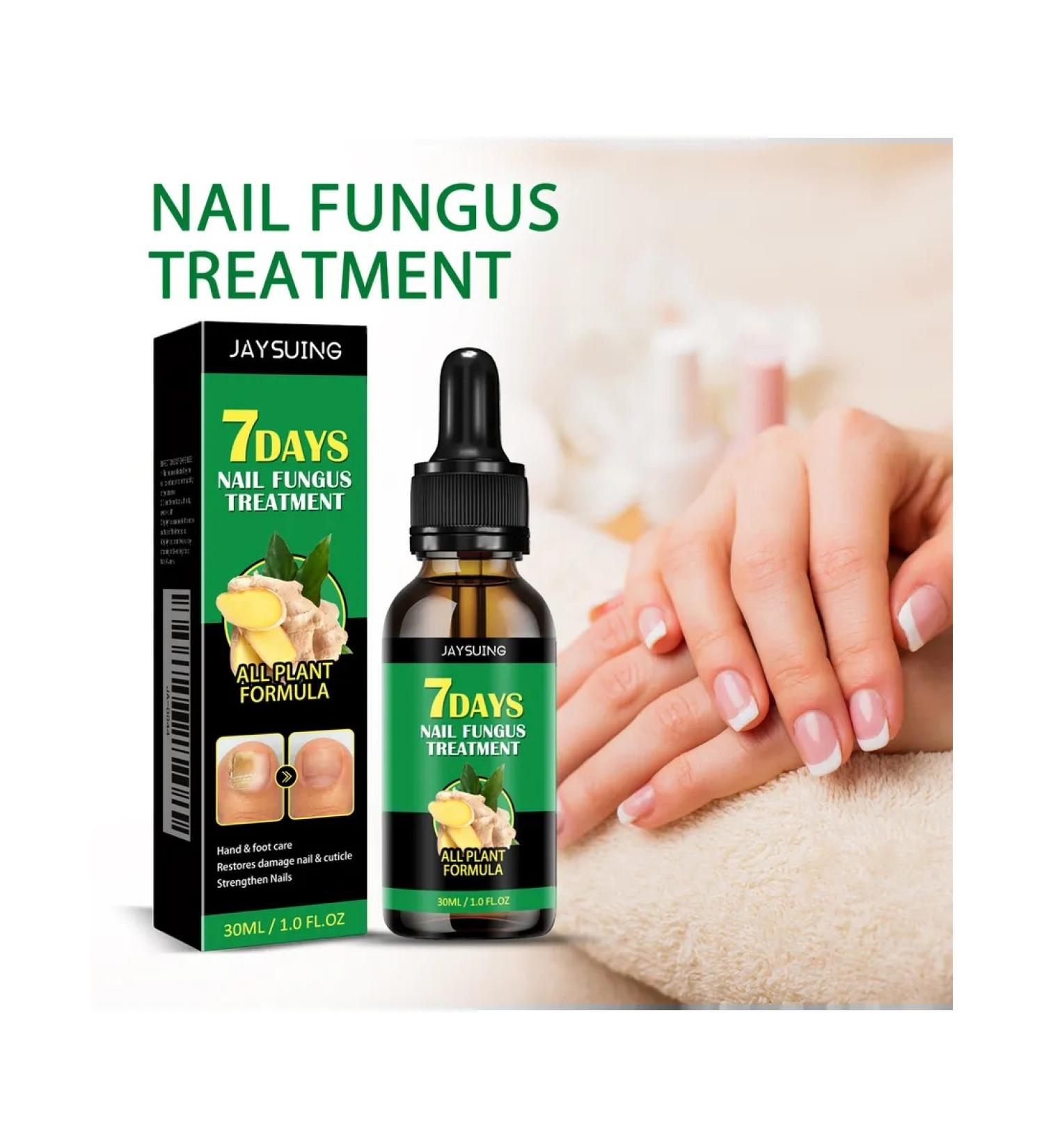 Solution for the treatment of nails with ginger jaysuing - Buy Online on GoSupps.com