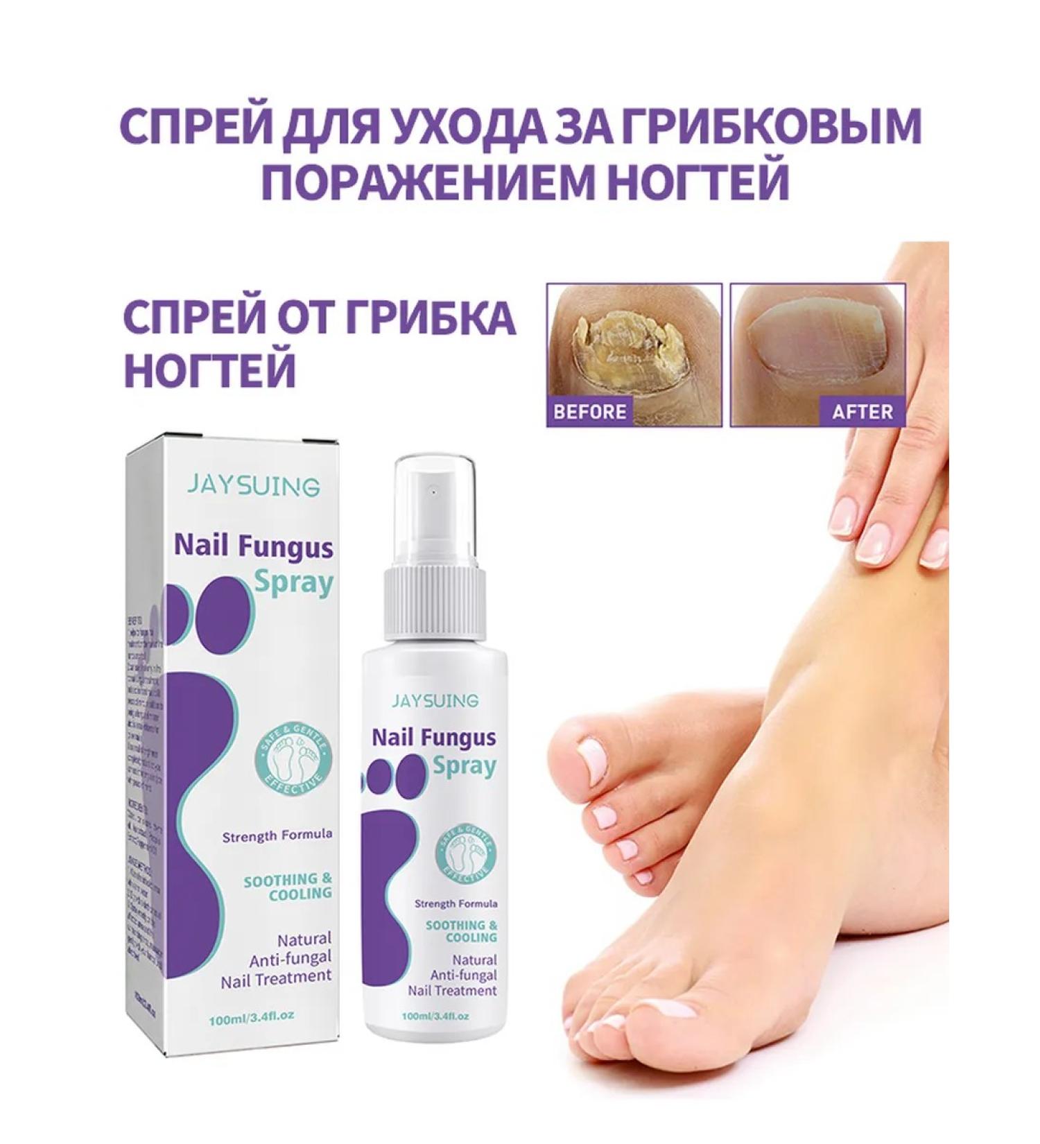 JaySuing nail fungus - Buy Online on GoSupps.com