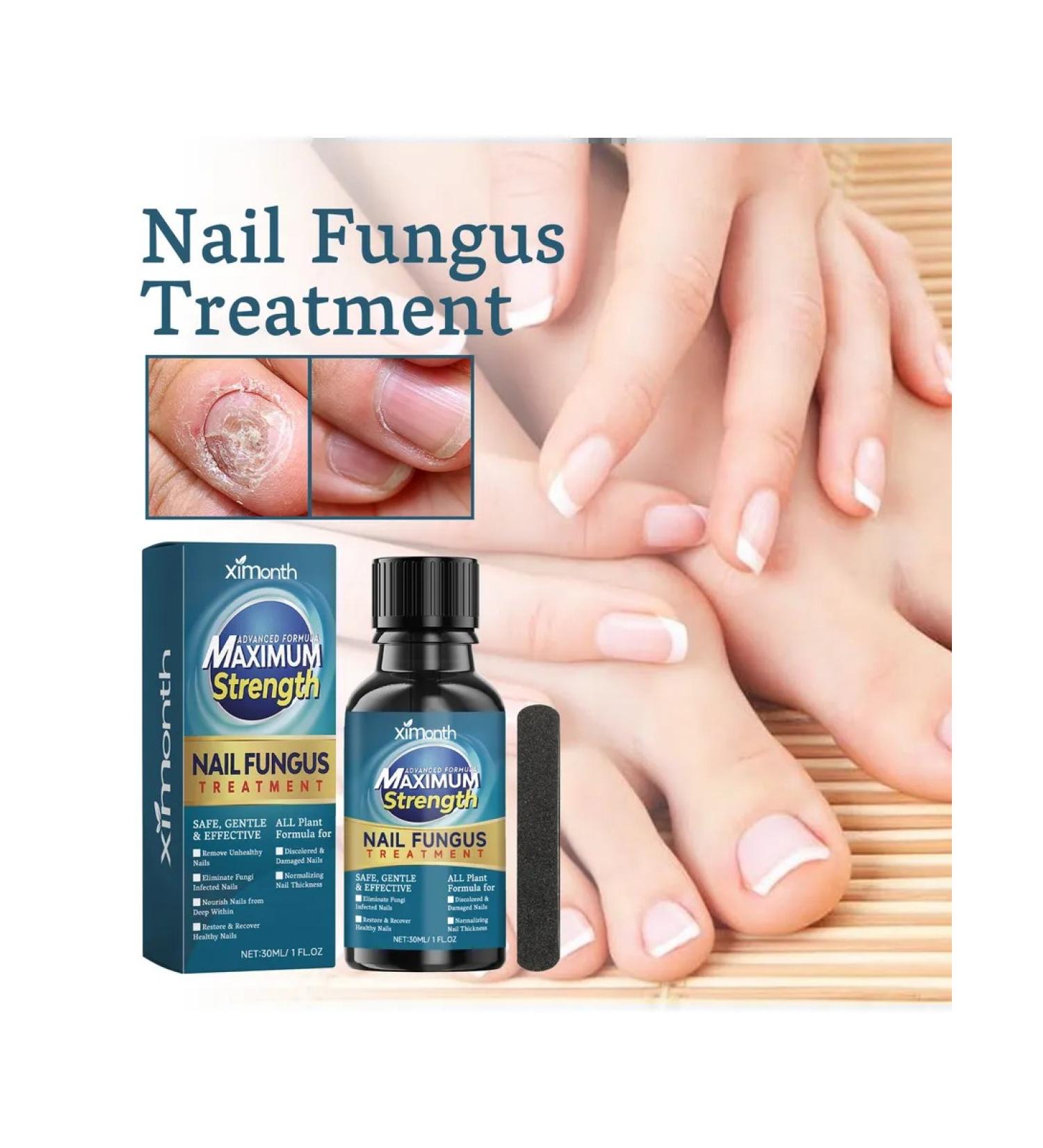 Nail repair solution XIMONTH - Buy Online on GoSupps.com
