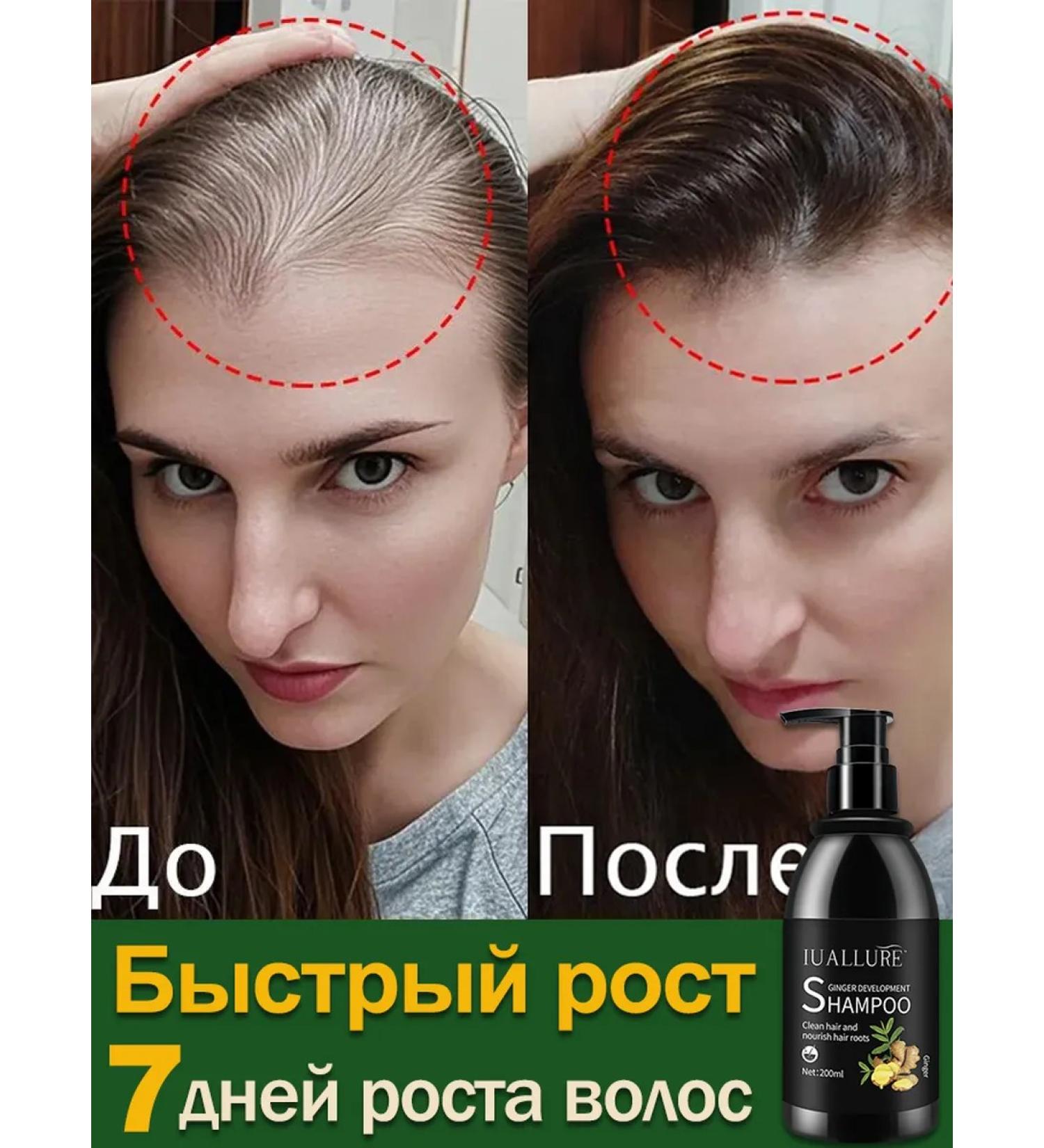 LYDIMOON Shampoo against falling out with ginger extract - Buy Online on GoSupps.com