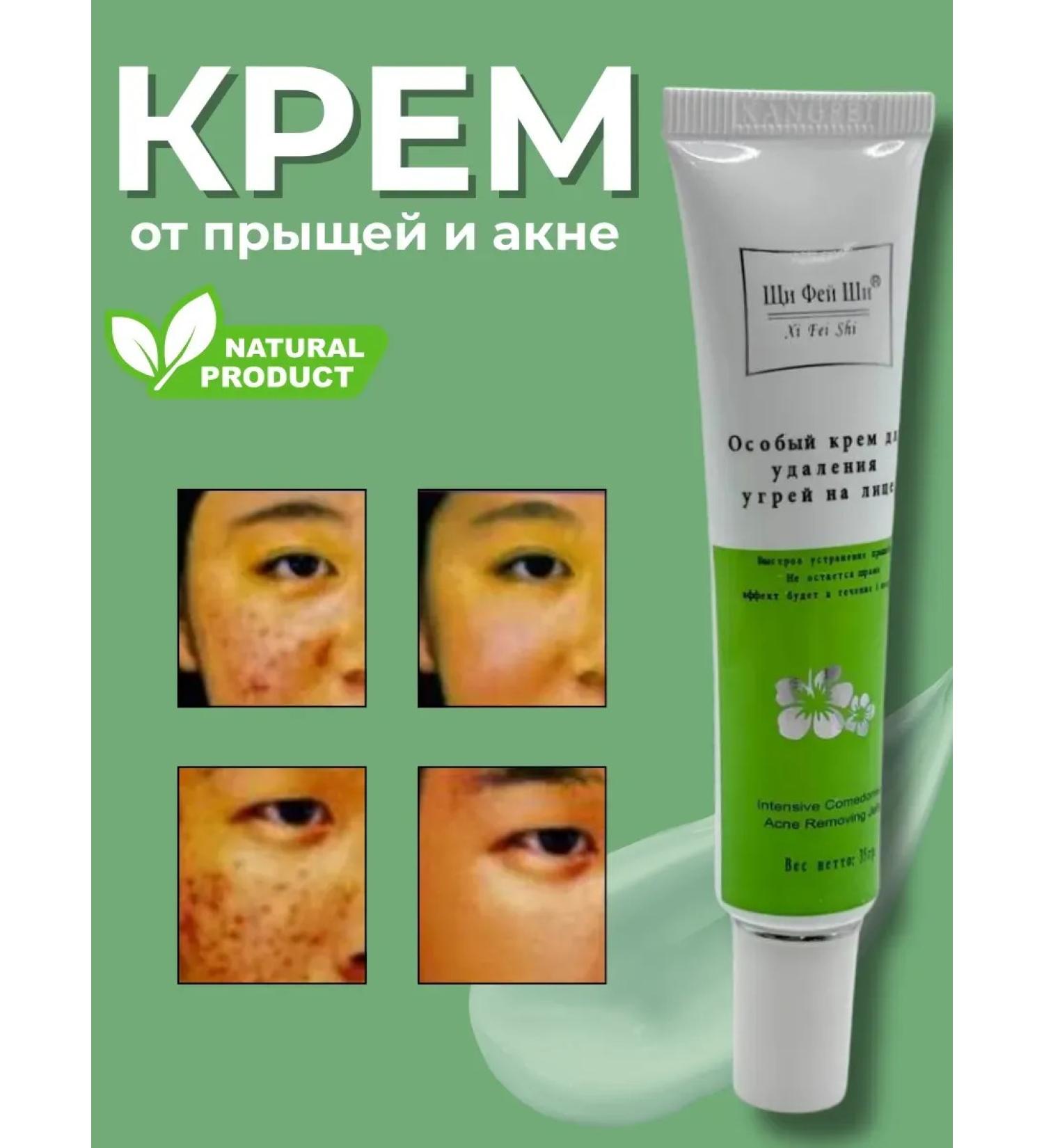ShaStyle1 Acne cream - Buy Online on GoSupps.com