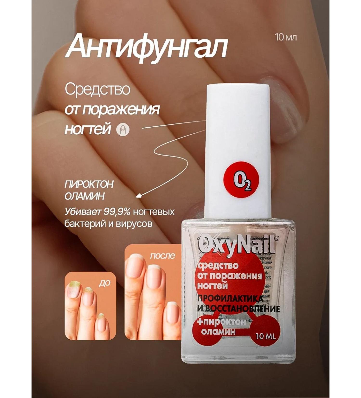 Oxynail Remedy for nail damage antifungol - Buy Online on GoSupps.com