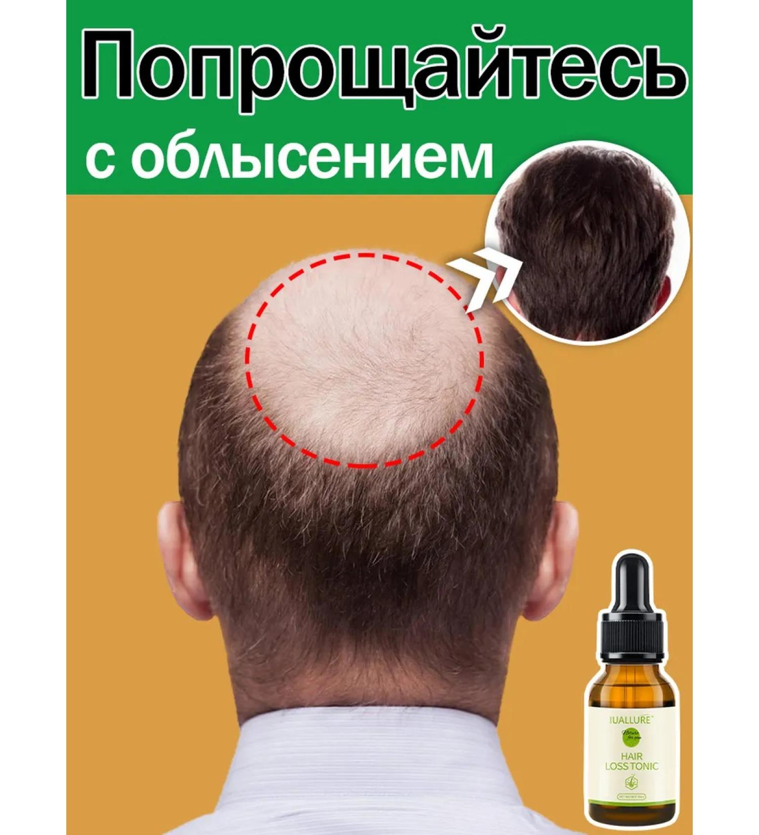 LYDIMOON Hair growth serum breaking the loss and baldness - Buy Online on GoSupps.com